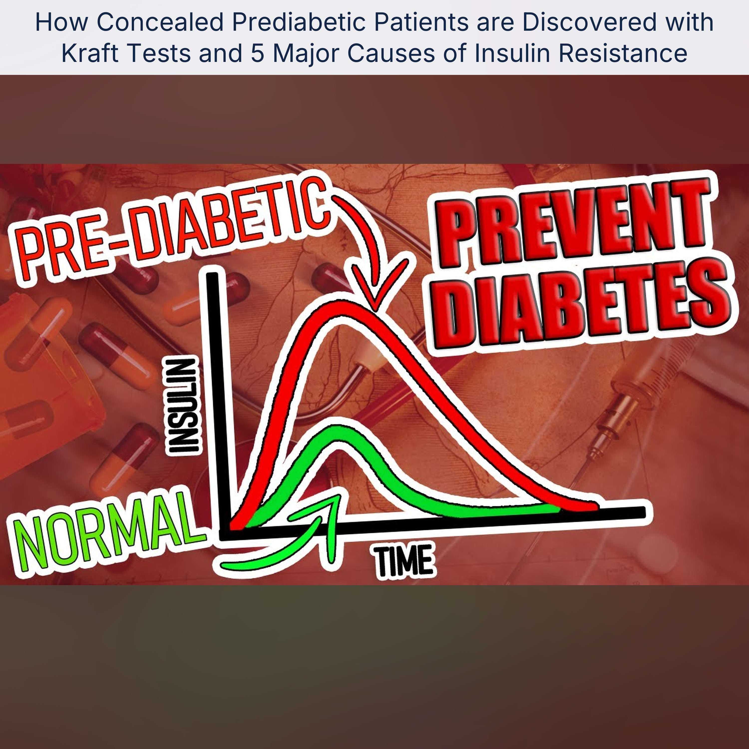 How Concealed Prediabetic Patients are Discovered with Kraft Tests and 5 Major Causes of Insulin Resistance episode artwork
