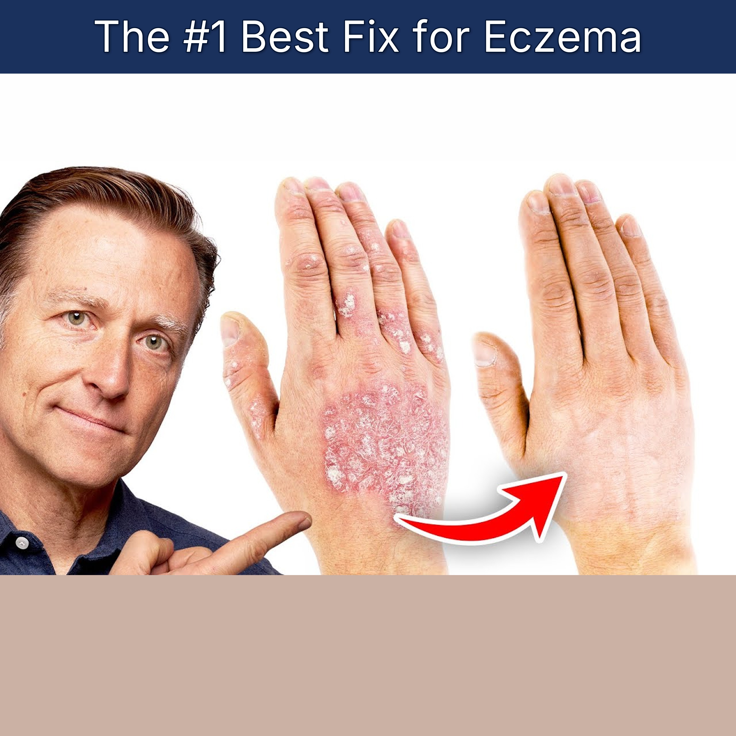 The #1 Best Fix for Eczema episode artwork