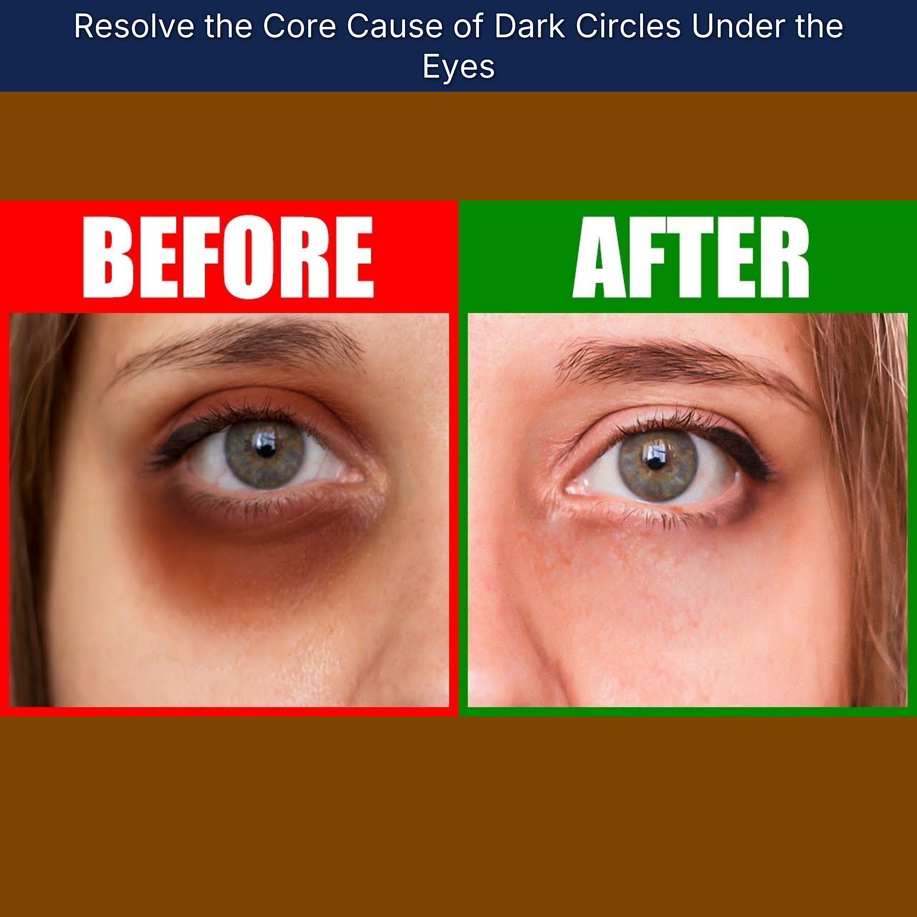 Resolve the Core Cause of Dark Circles Under the Eyes episode artwork