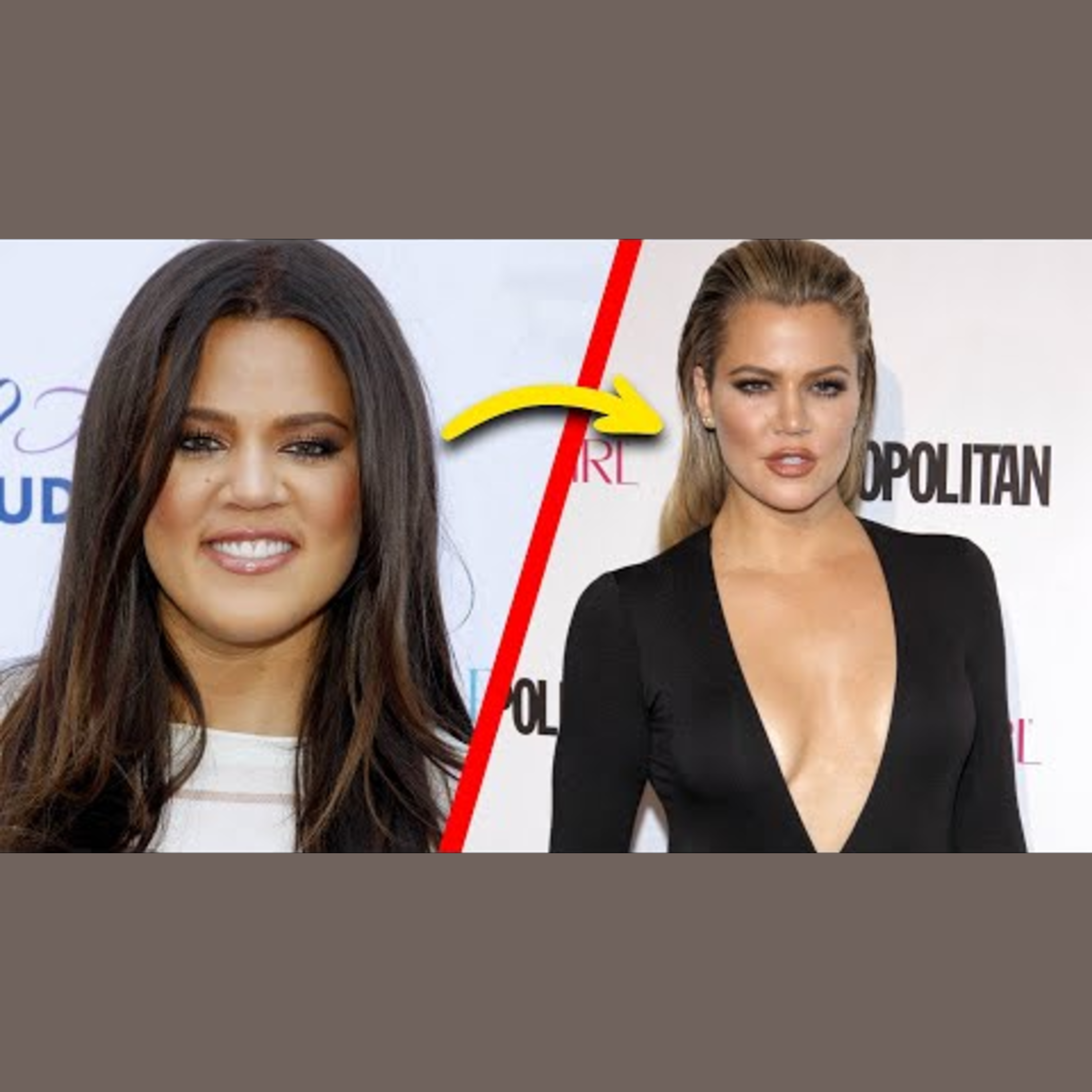 Khloe Kardashian's Dramatic Body Transformation Revealed episode artwork