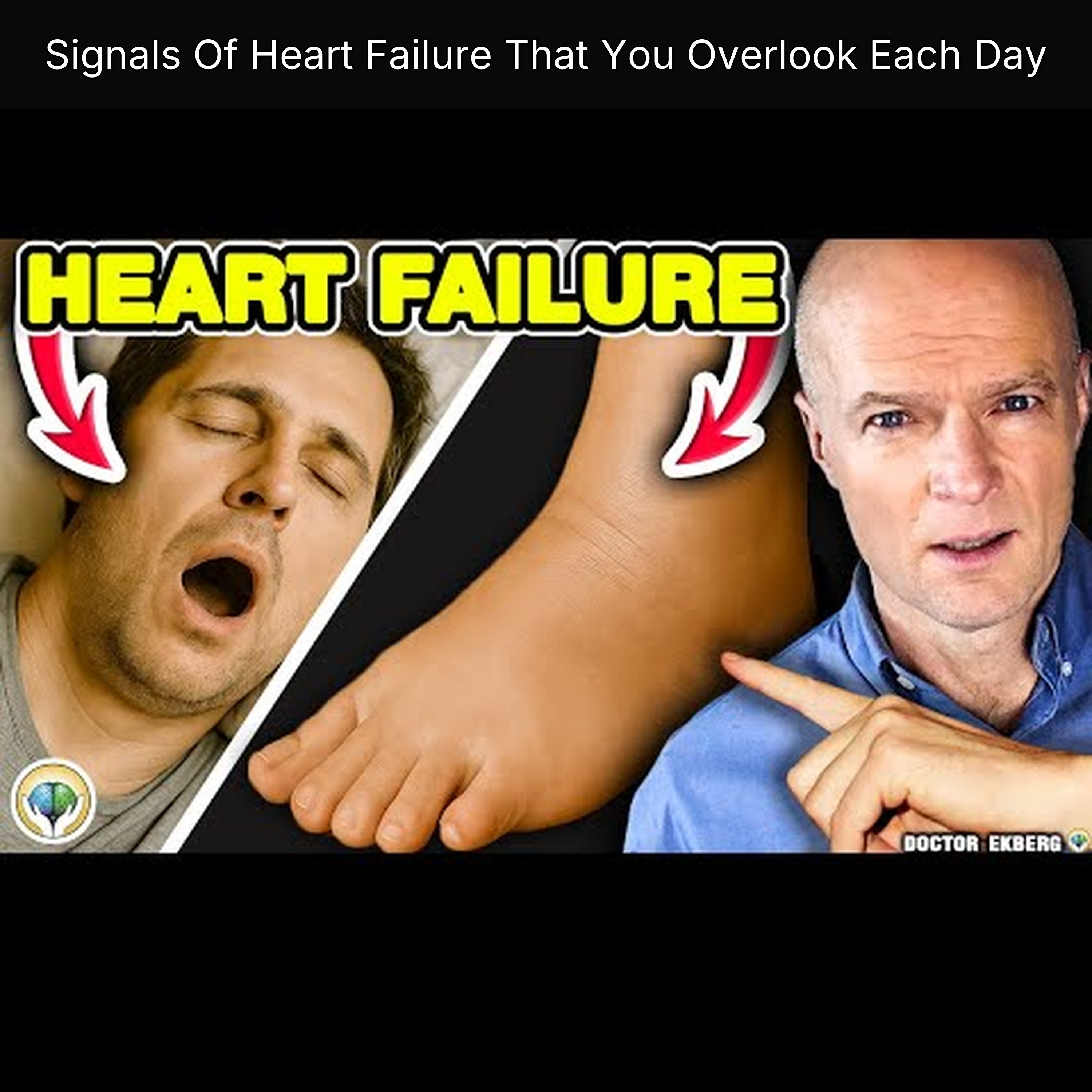 Signals Of Heart Failure That You Overlook Each Day