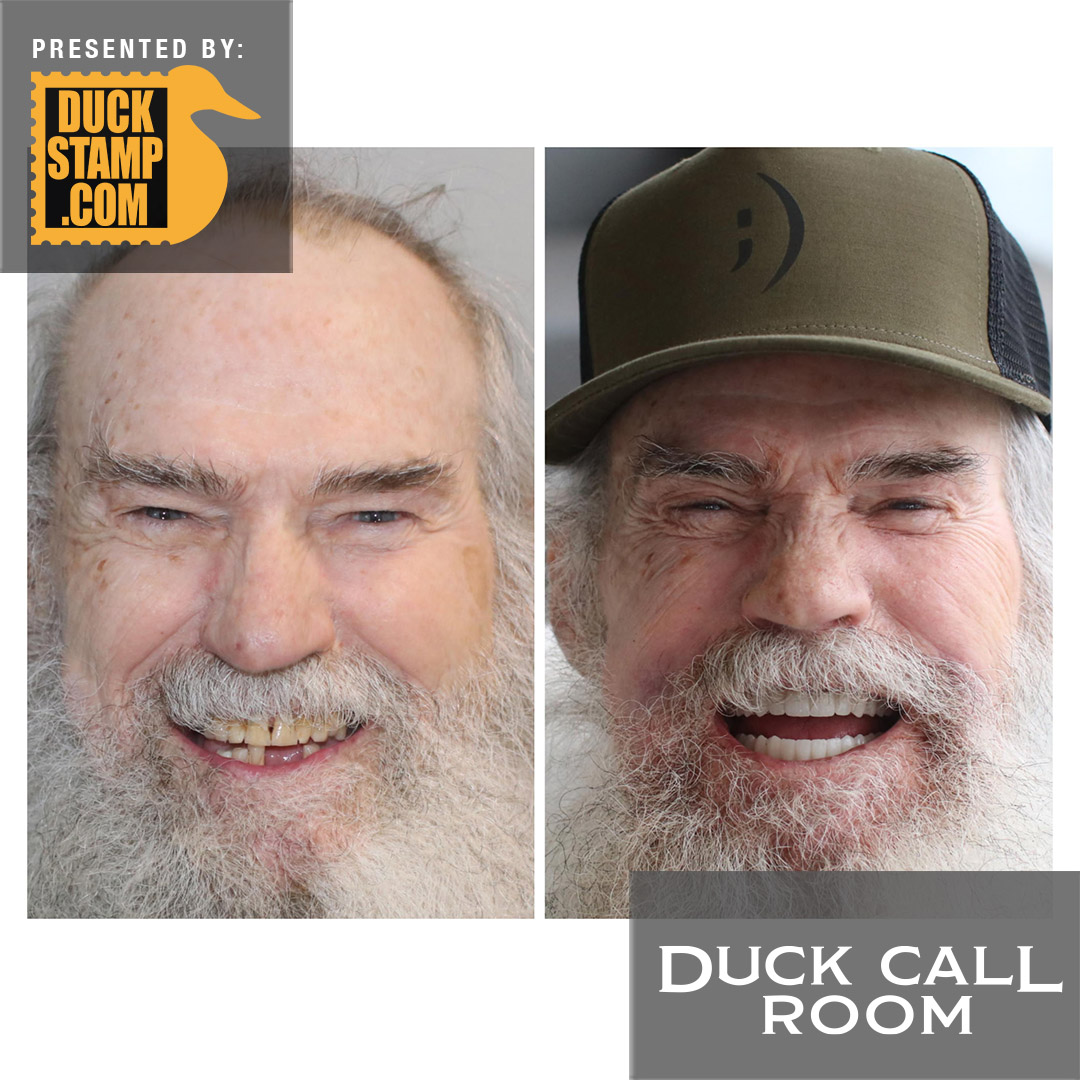Uncle Si Unveils His New Teeth & a Bigger Grin