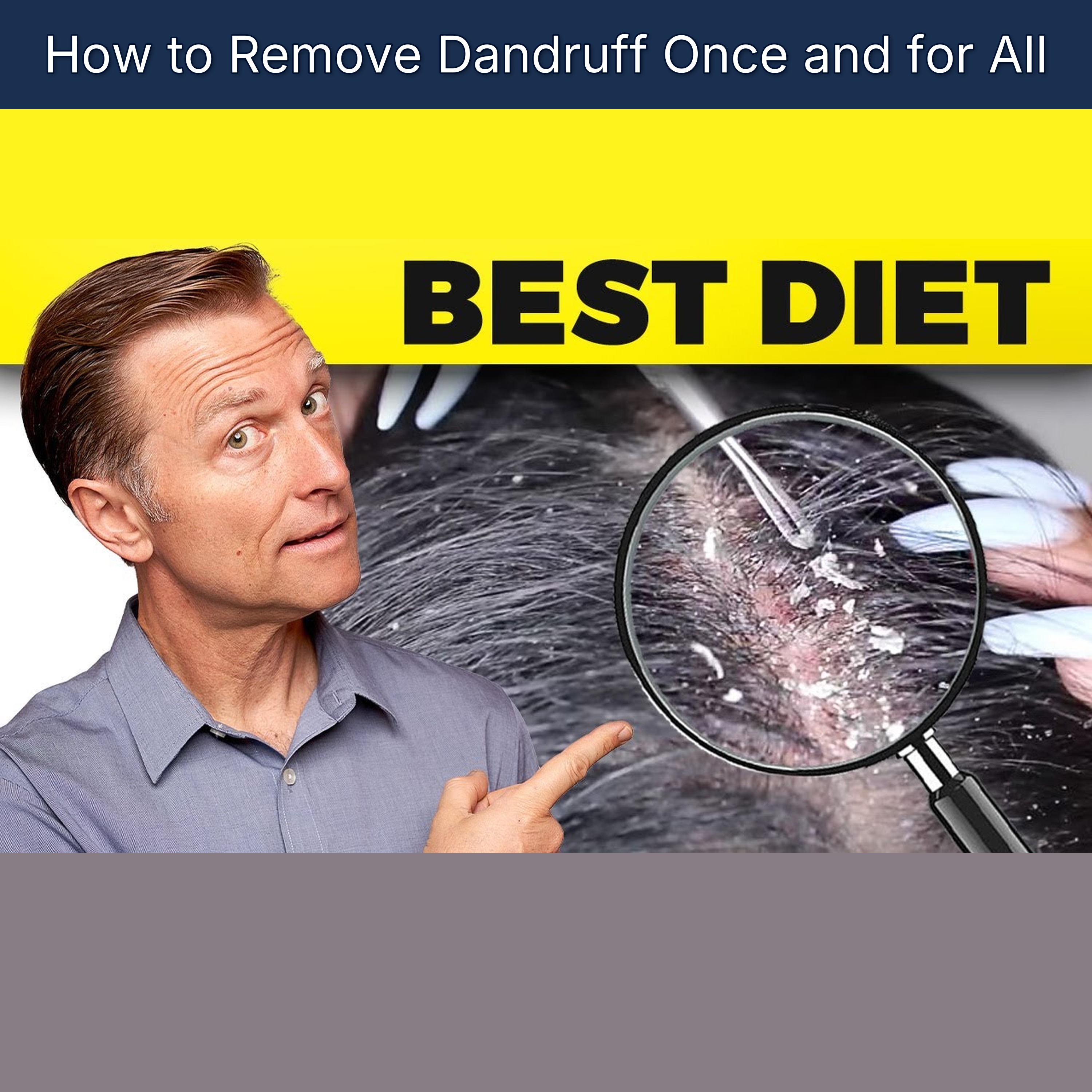 How to Remove Dandruff Once and for All
