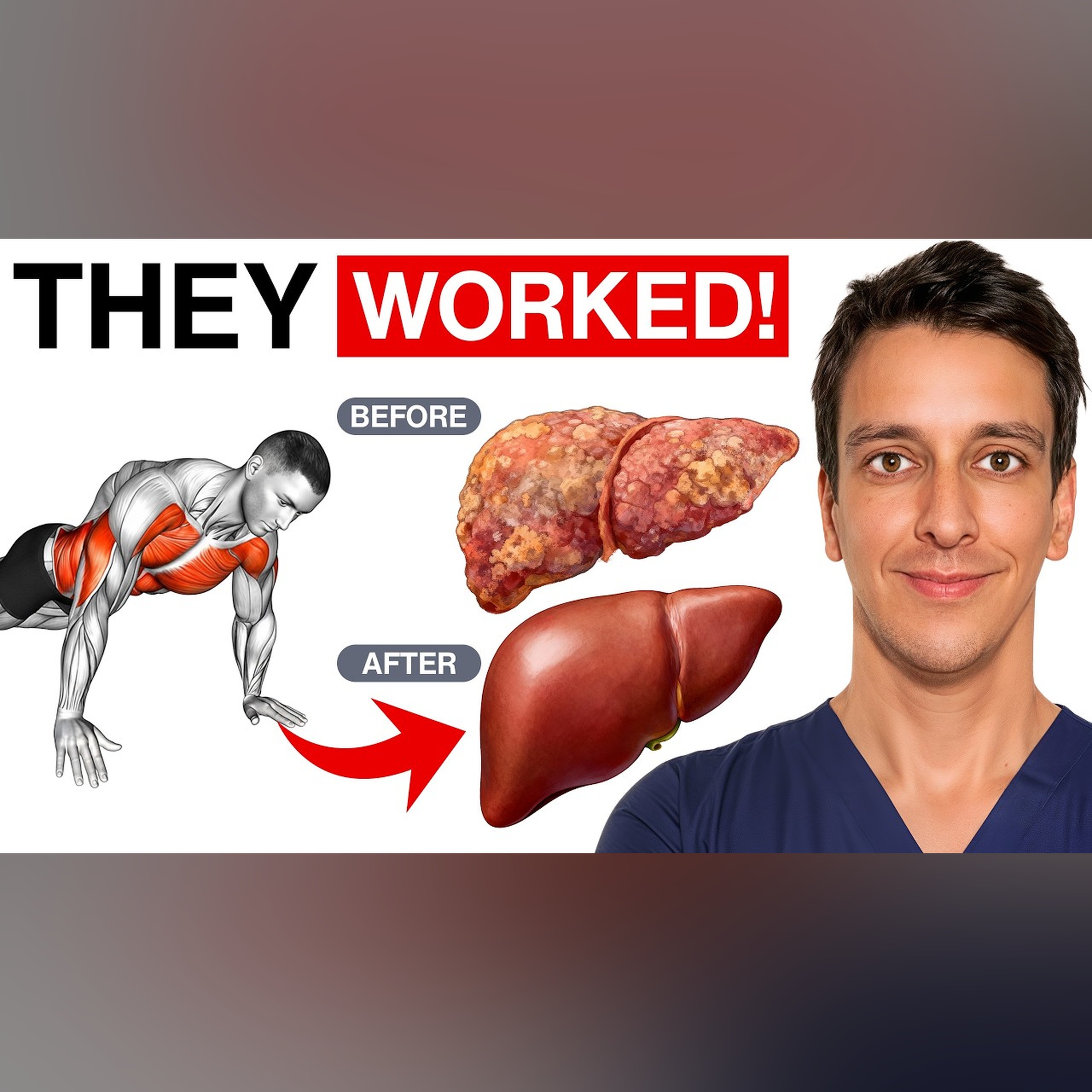 Fix your Fatty Liver with THIS workout