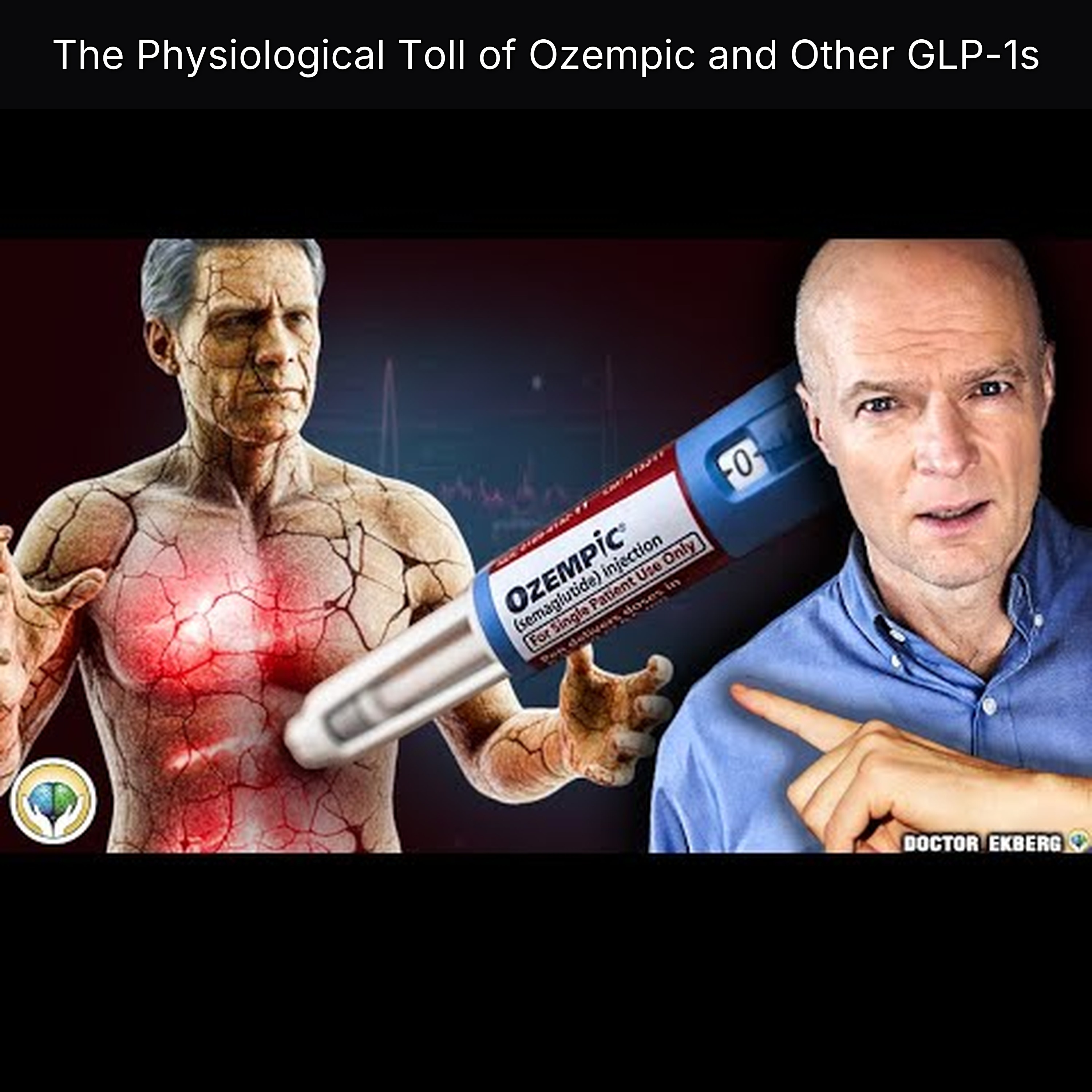 The Physiological Toll of Ozempic and Other GLP-1s