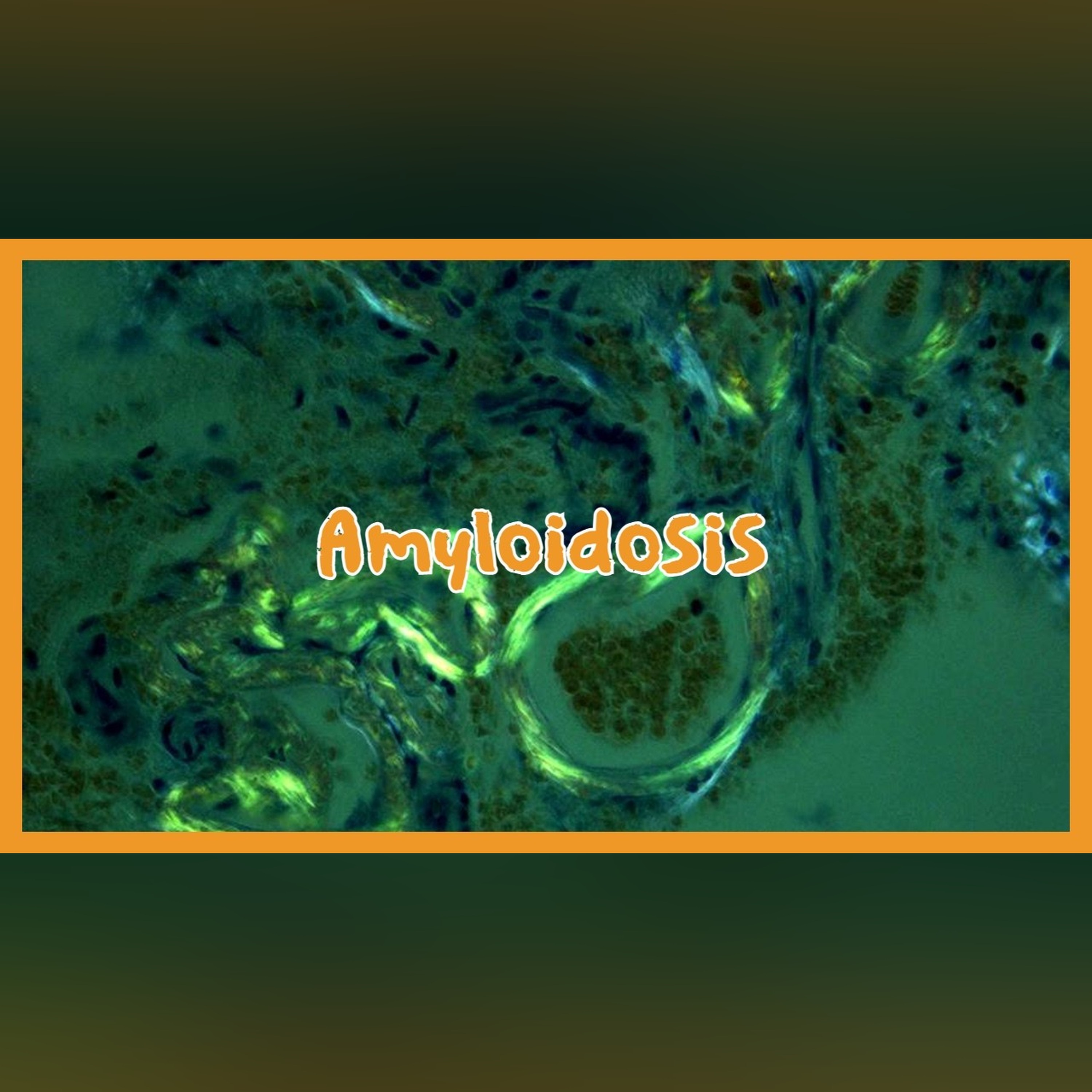 Amyloidosis episode artwork