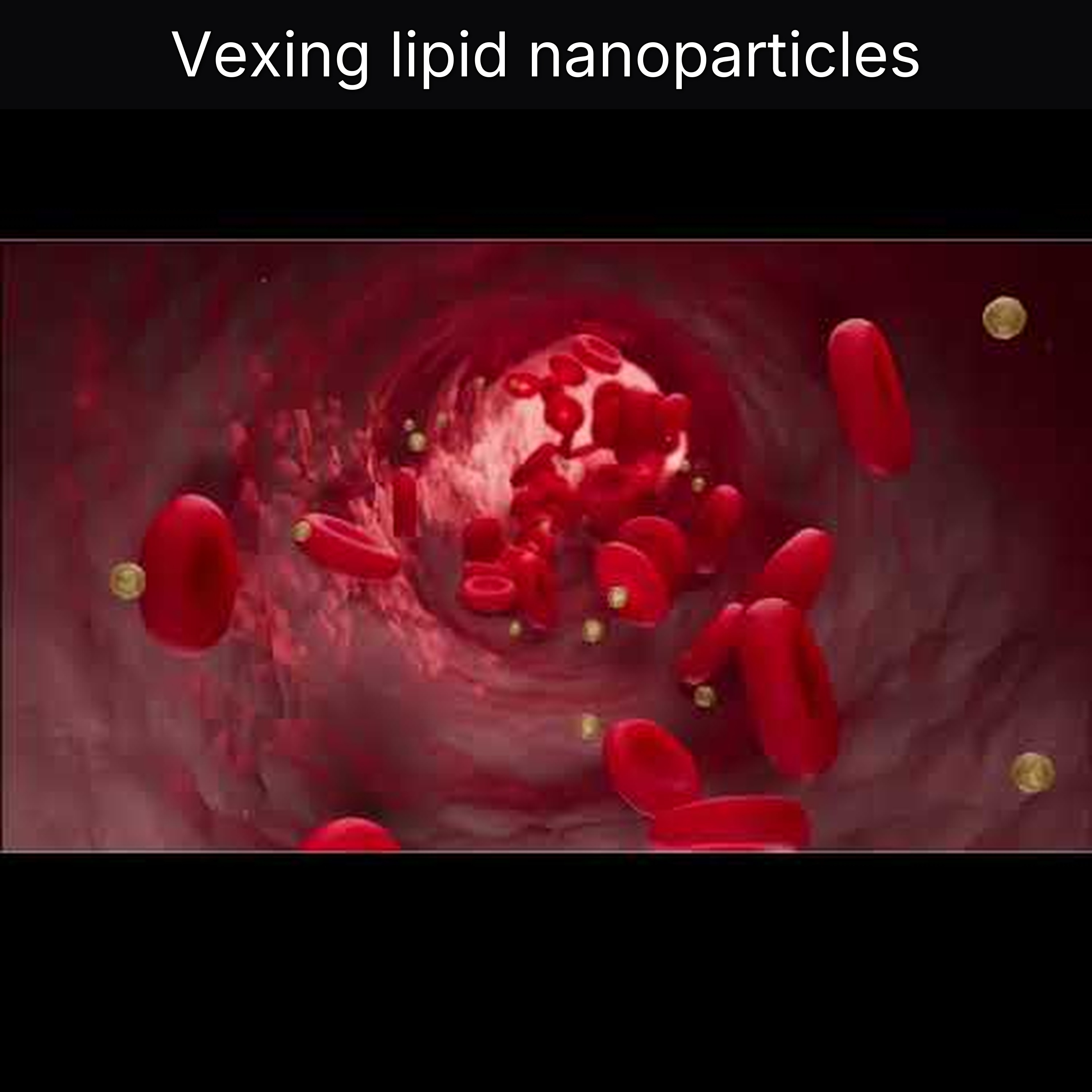 Vexing lipid nanoparticles
