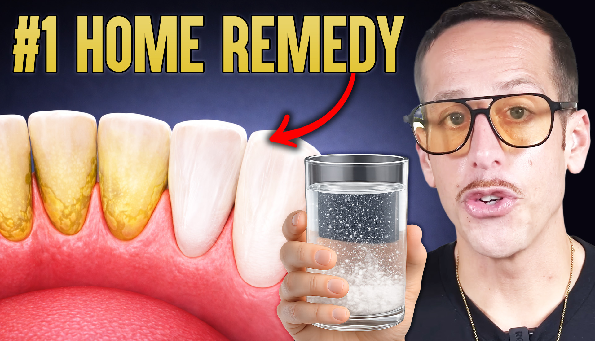 Why Yellow Teeth Are a Metabolic Warning Sign (And How to Whiten Naturally Without Damaging Your Enamel) | #1241
