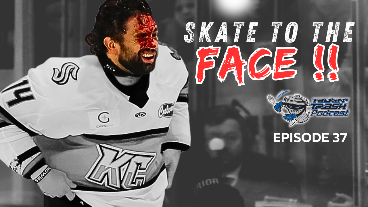 'Diamond Hands' Take a Skate to The Face !