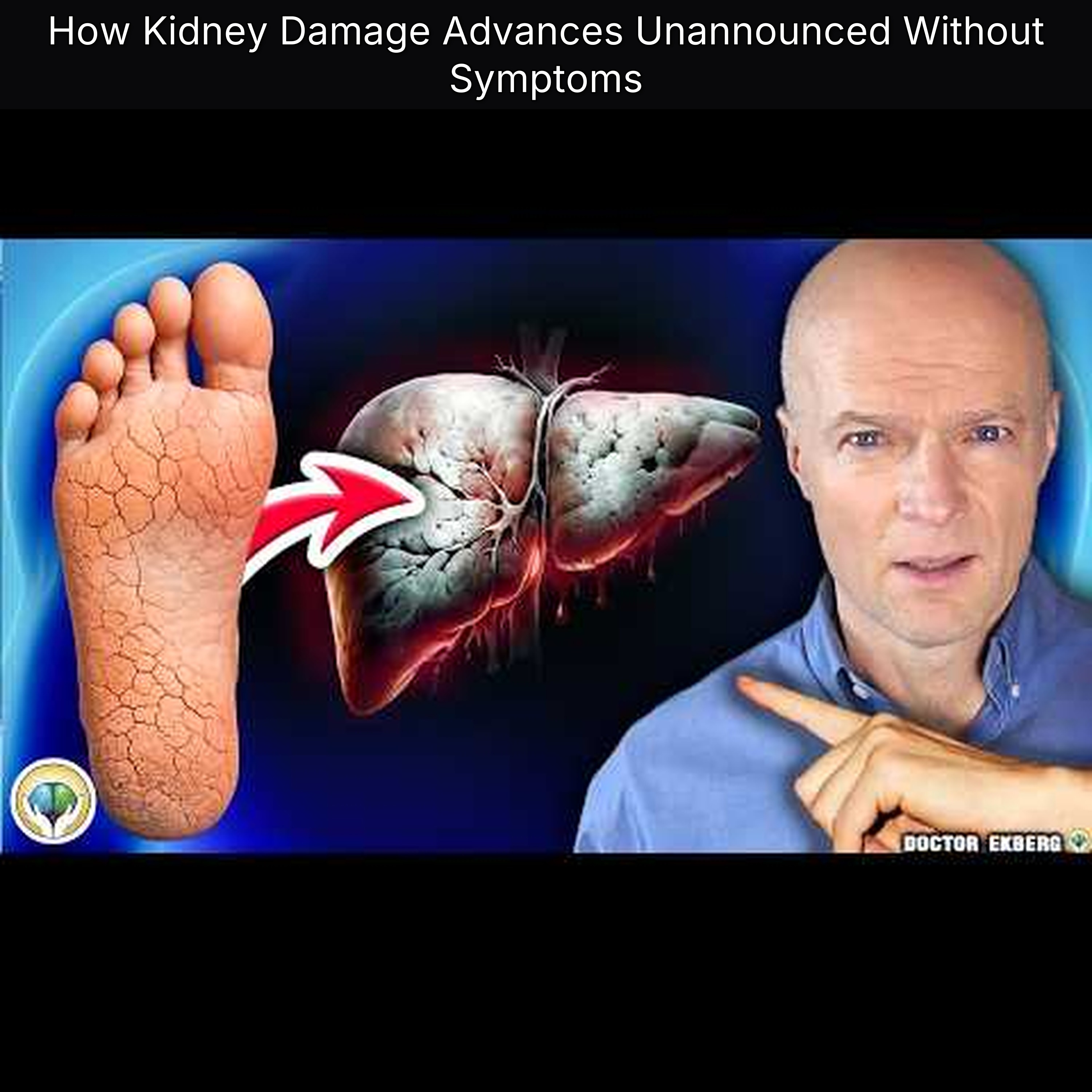 How Kidney Damage Advances Unannounced Without Symptoms
