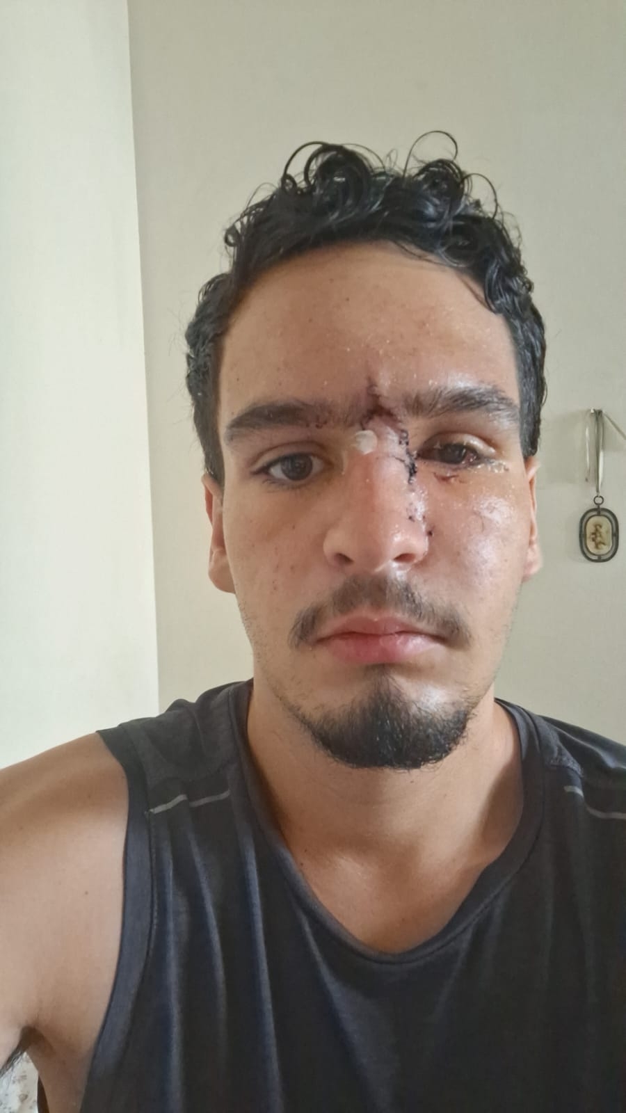 Jovem que perdeu a visão após ser atingido por bala de borracha da PM irá processar o estado do RJ episode artwork