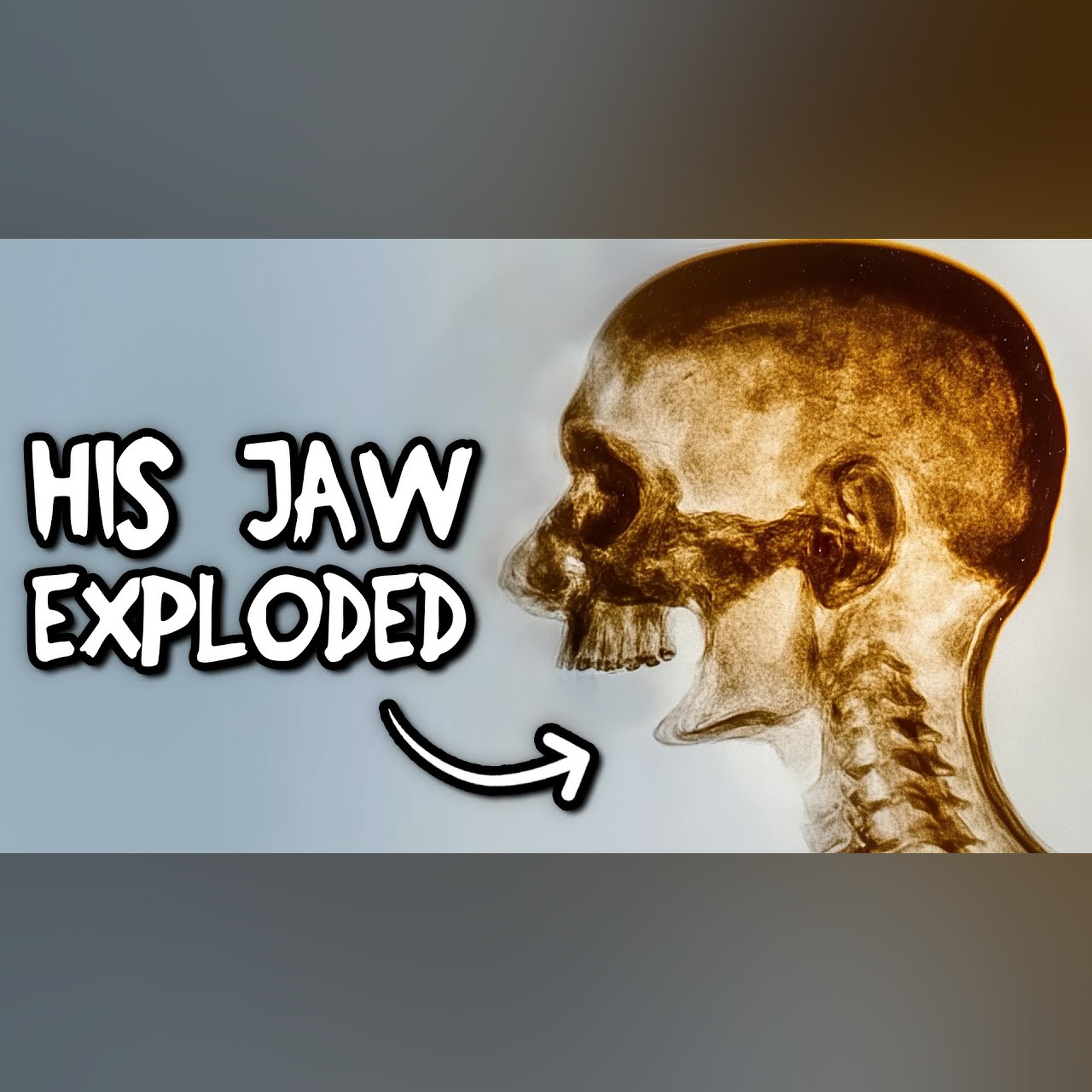 The Man Who Turned His Chewing Gum into a Bomb. He Made 1 Mistake. episode artwork