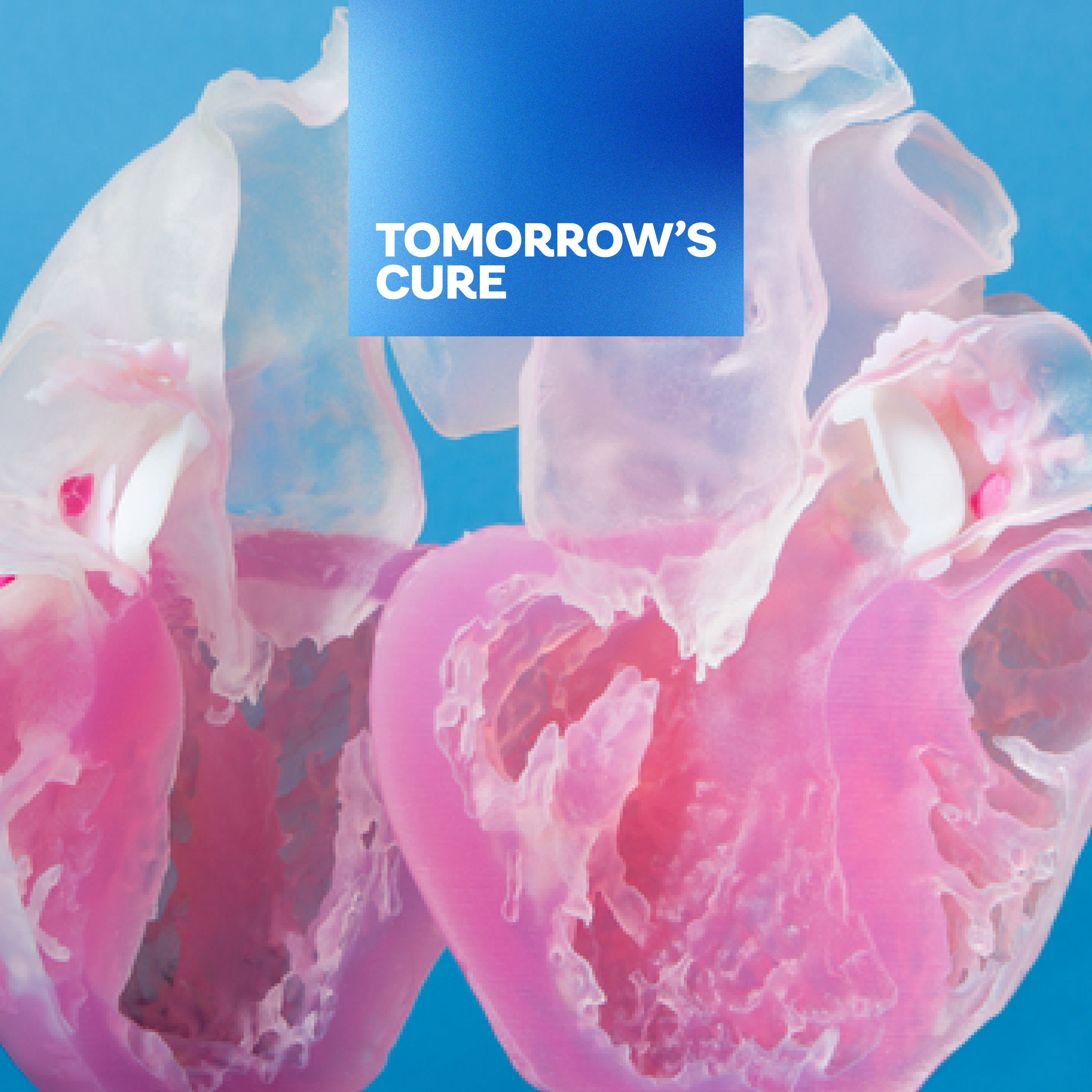 Thumbnail for "How AI is Transforming Organ Transplants".