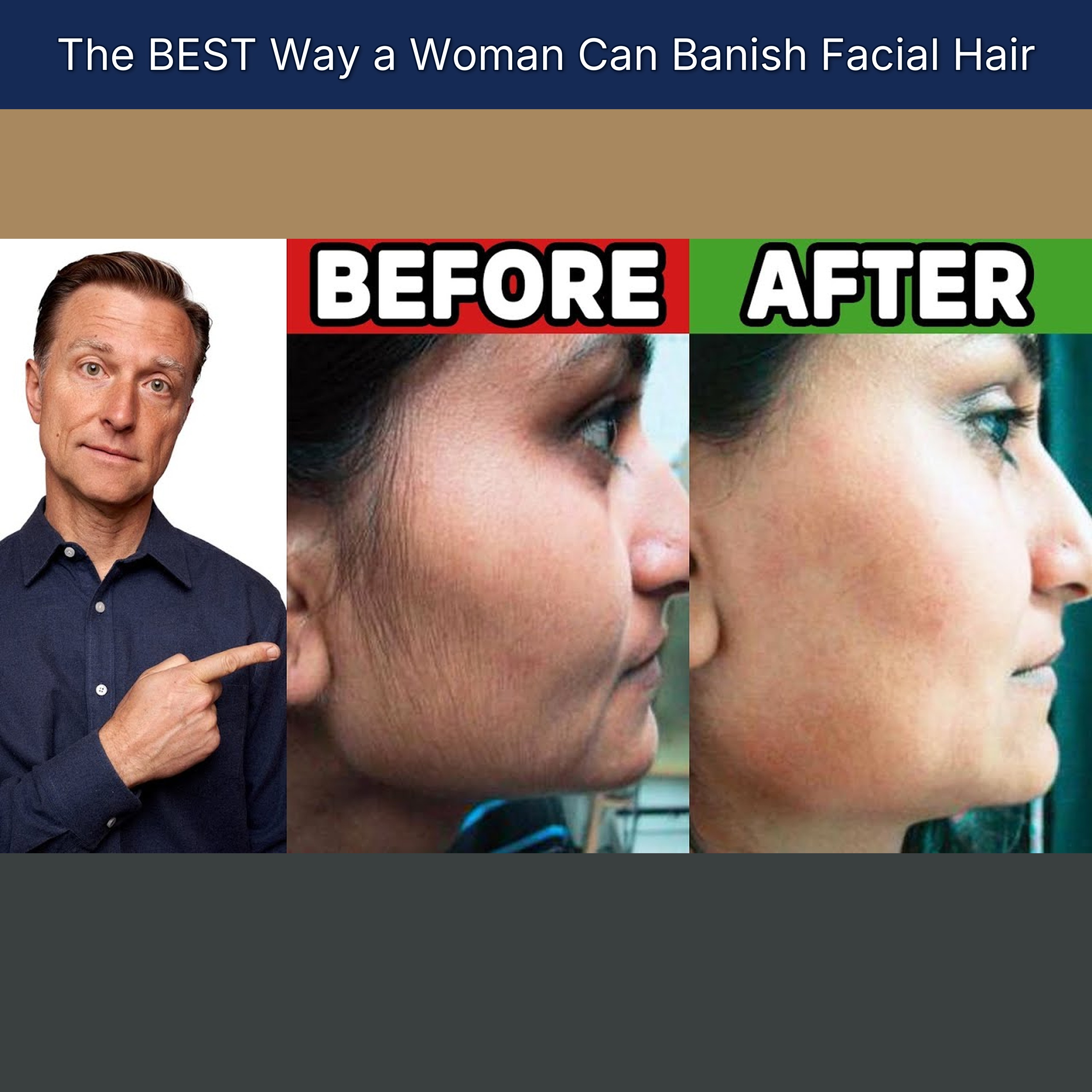 The BEST Way a Woman Can Banish Facial Hair episode artwork