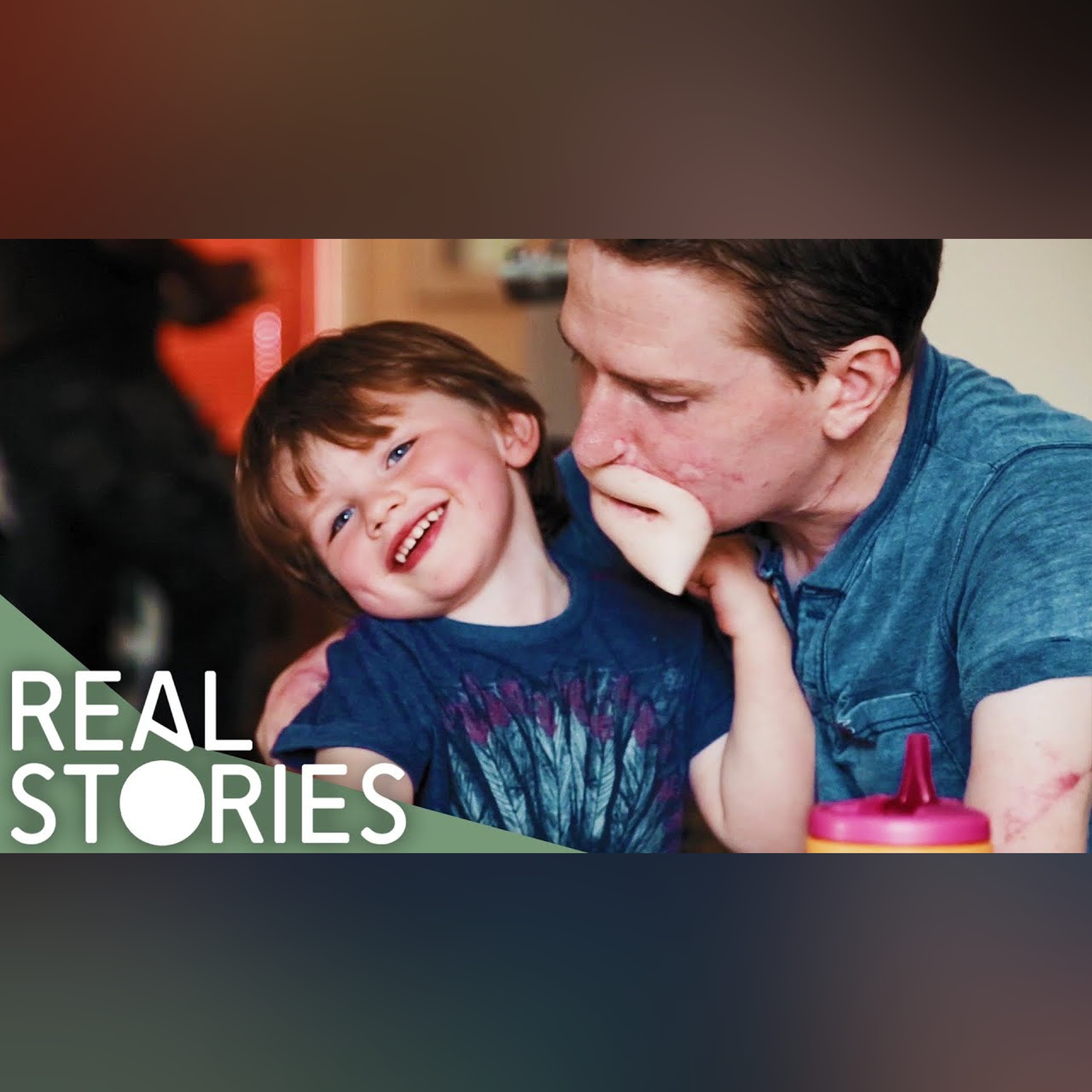 How Did Alex Lewis' Family Cope With His Illness?