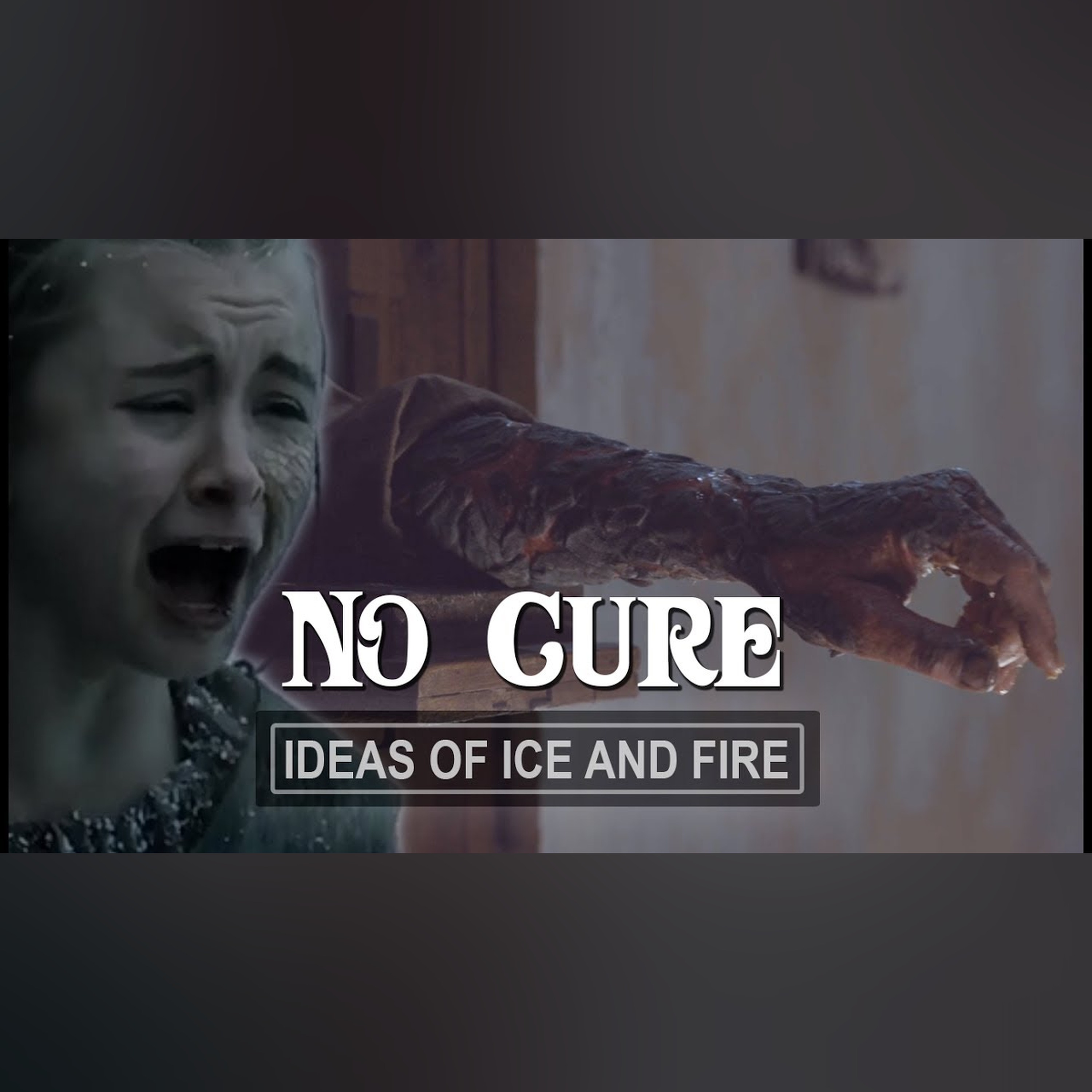 There is No Cure for Greyscale | Game of Thrones Season 7 QandA