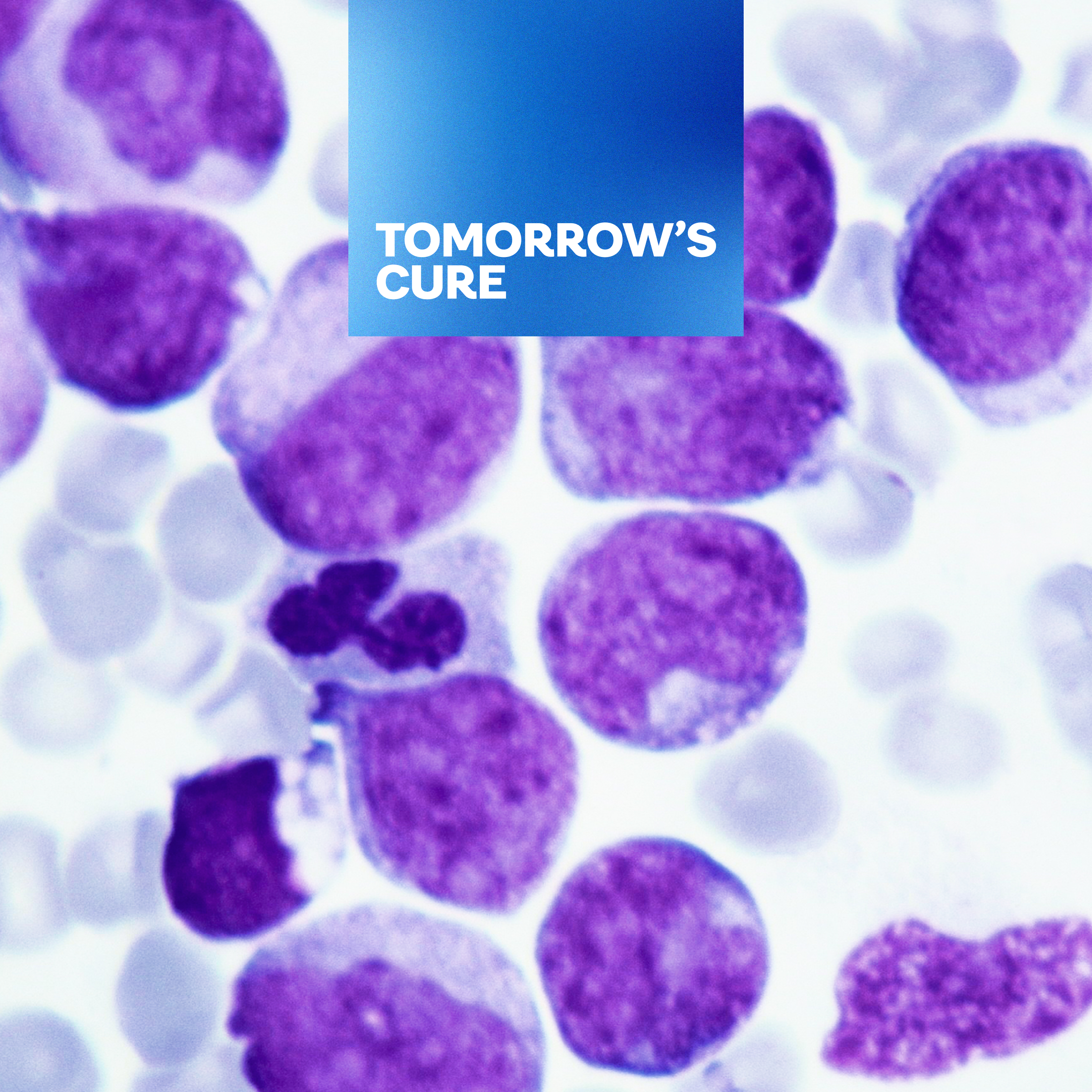 How Nuclear Medicine Helps Cancer Patients