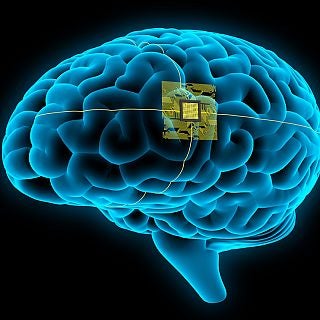 No es magia es ciencia: El implante cerebral que traduce pensamientos en habla