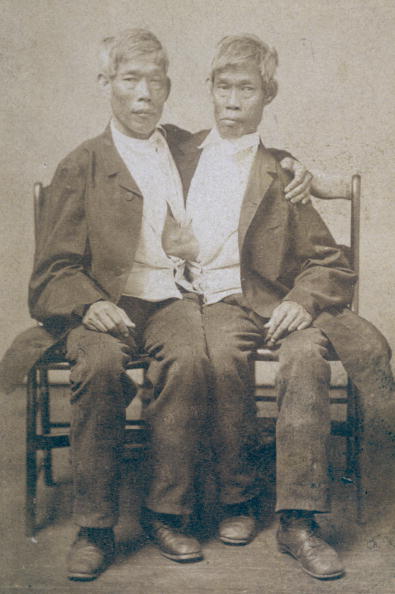 The Original Siamese Twins
