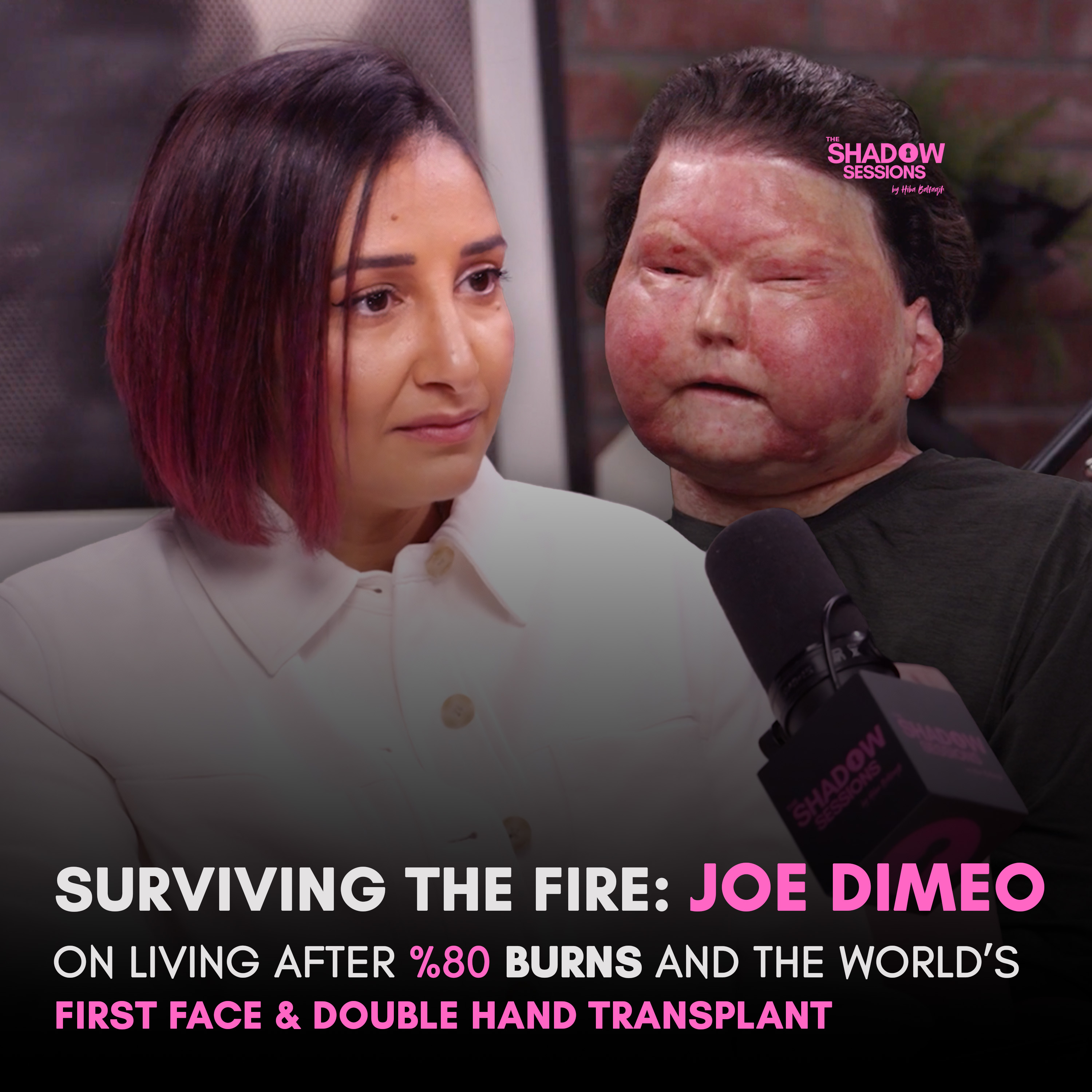 Joe DiMeo on Living After 80% Burns and the World’s First Face & Double Hand Transplant