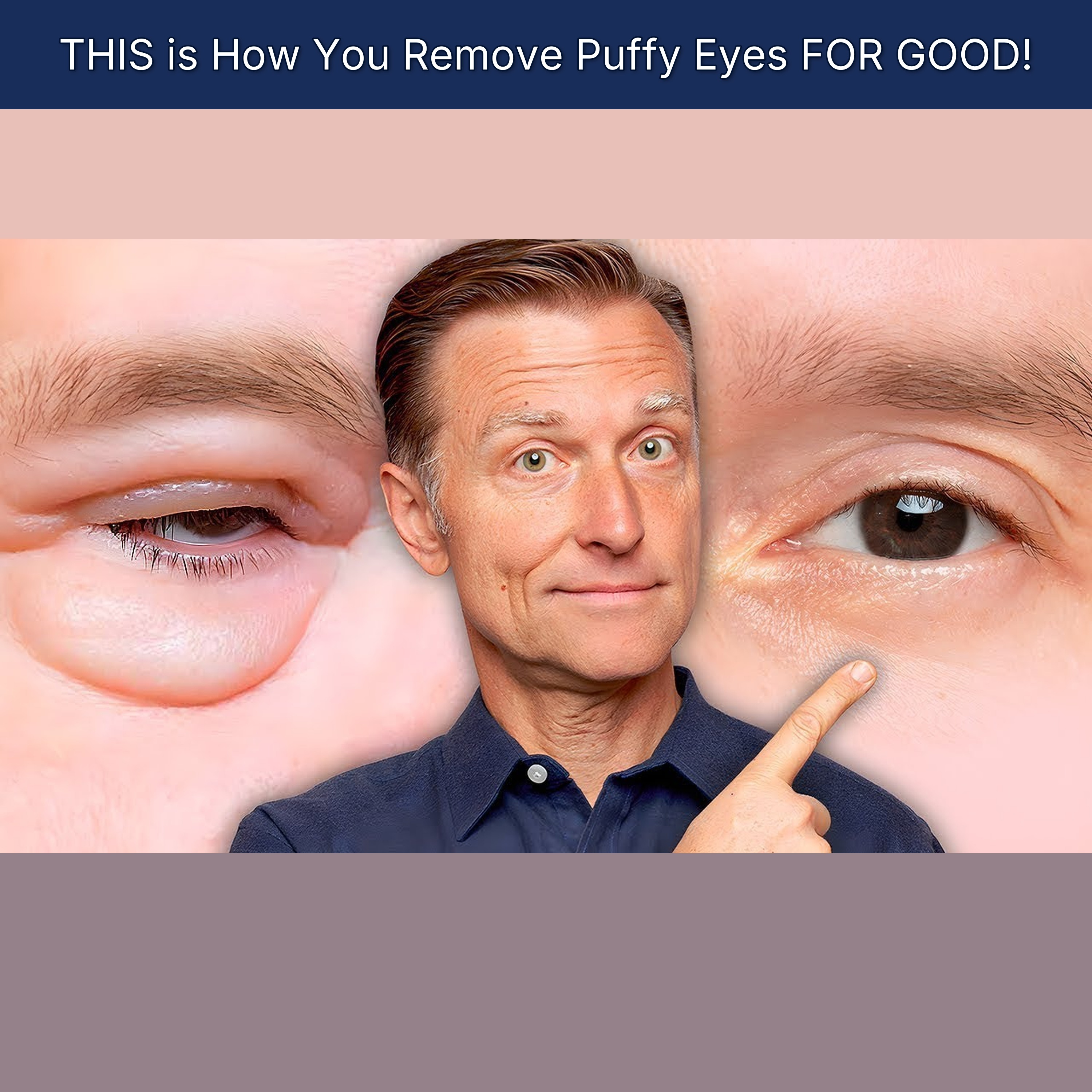 THIS is How You Remove Puffy Eyes FOR GOOD! episode artwork