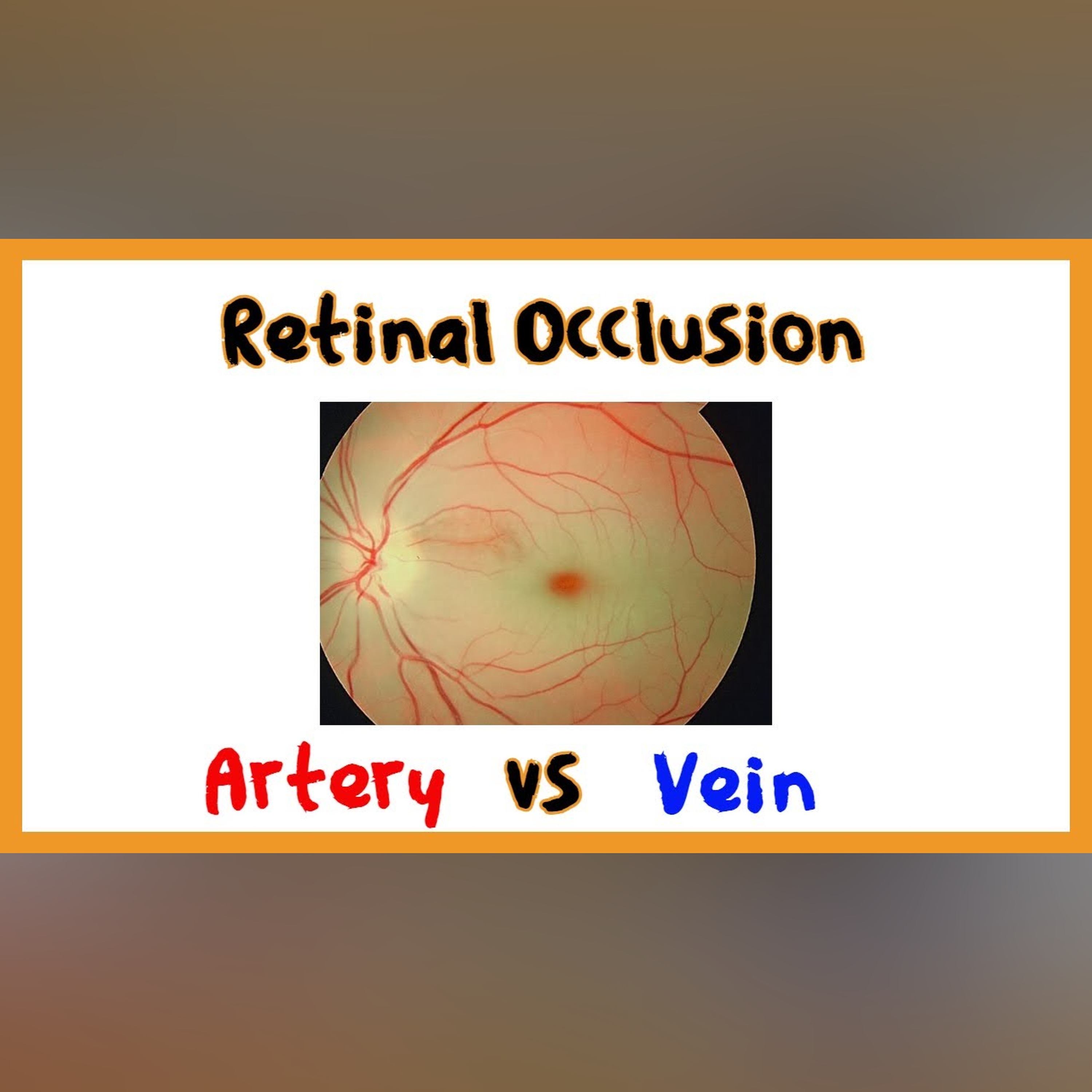 Retinal Artery Occlusion vs. Retinal Vein Occlusion episode artwork