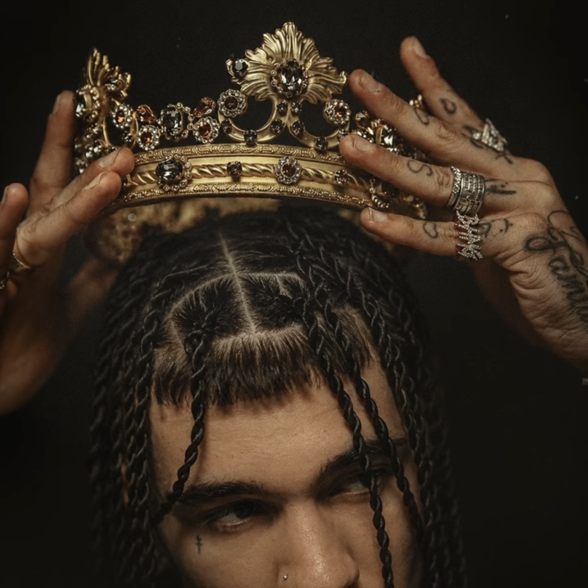 RONDO - CORONA (SFERA EBBASTA DISSING)