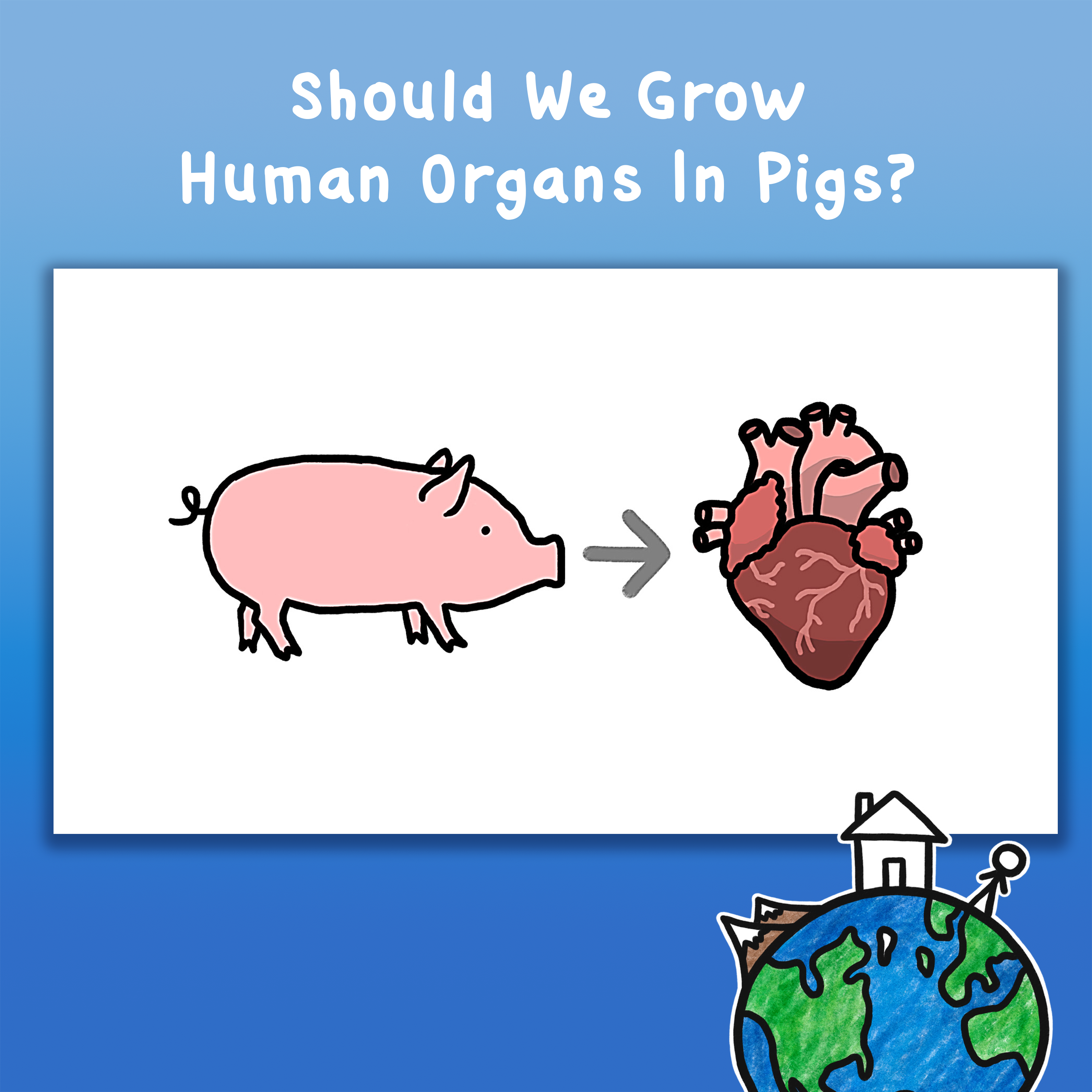 Should We Grow Human Organs In Pigs?