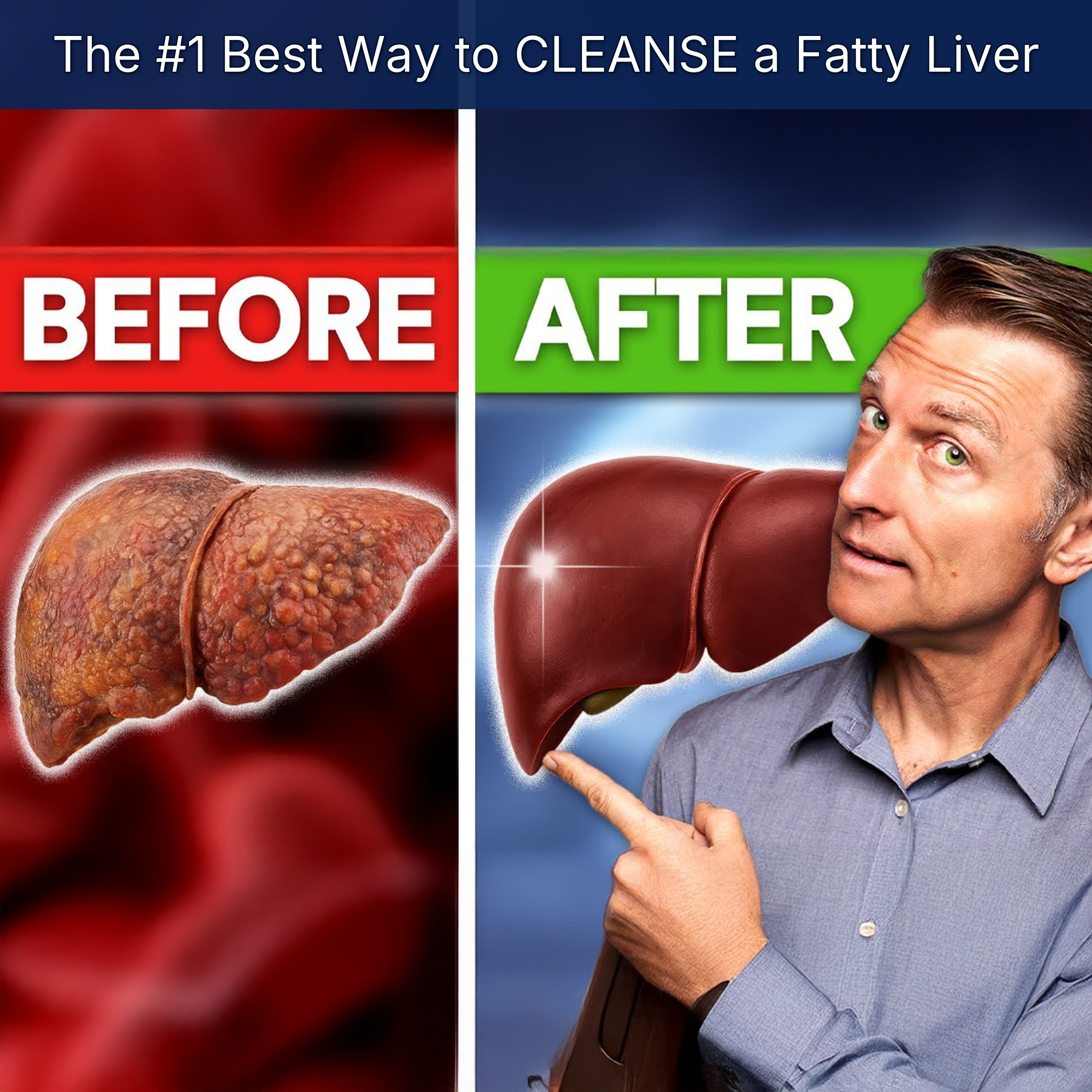 The #1 Best Way to CLEANSE a Fatty Liver episode artwork