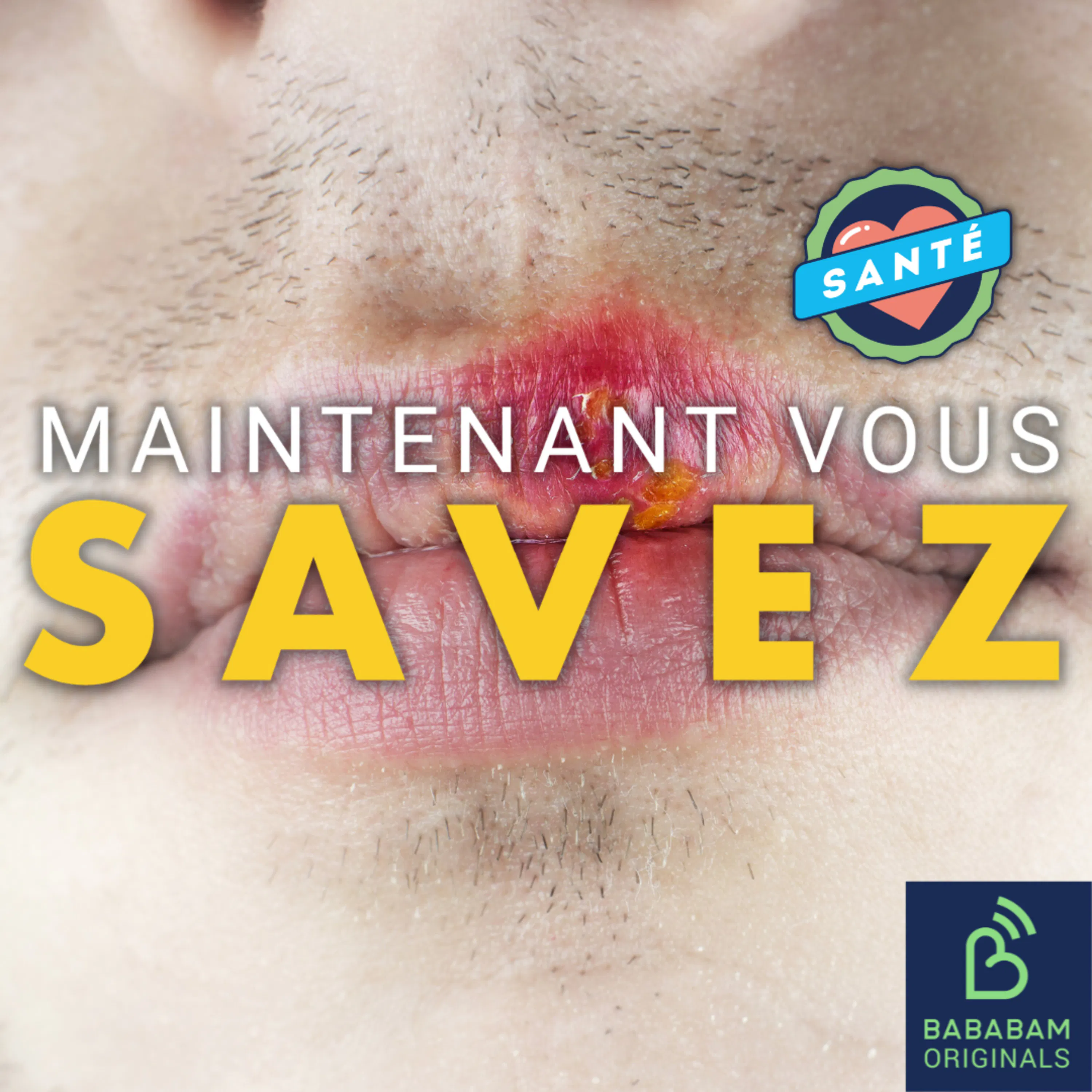 Herpès : comment se prémunir de cette maladie fréquente ?