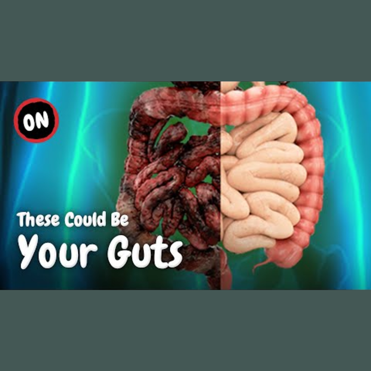 Exploring the Health Impacts of a Gluten-Free Lifestyle episode artwork