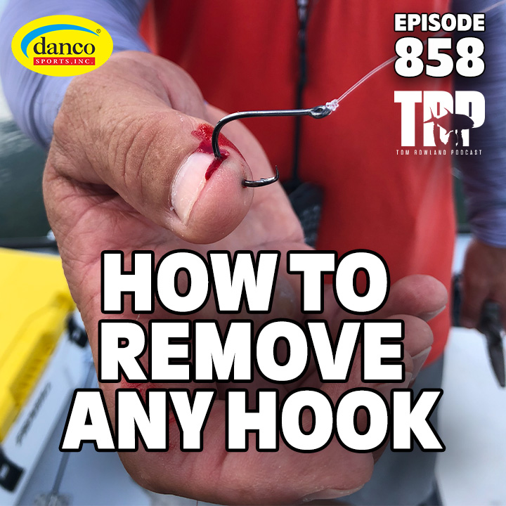 How to Remove ANY Hook!
