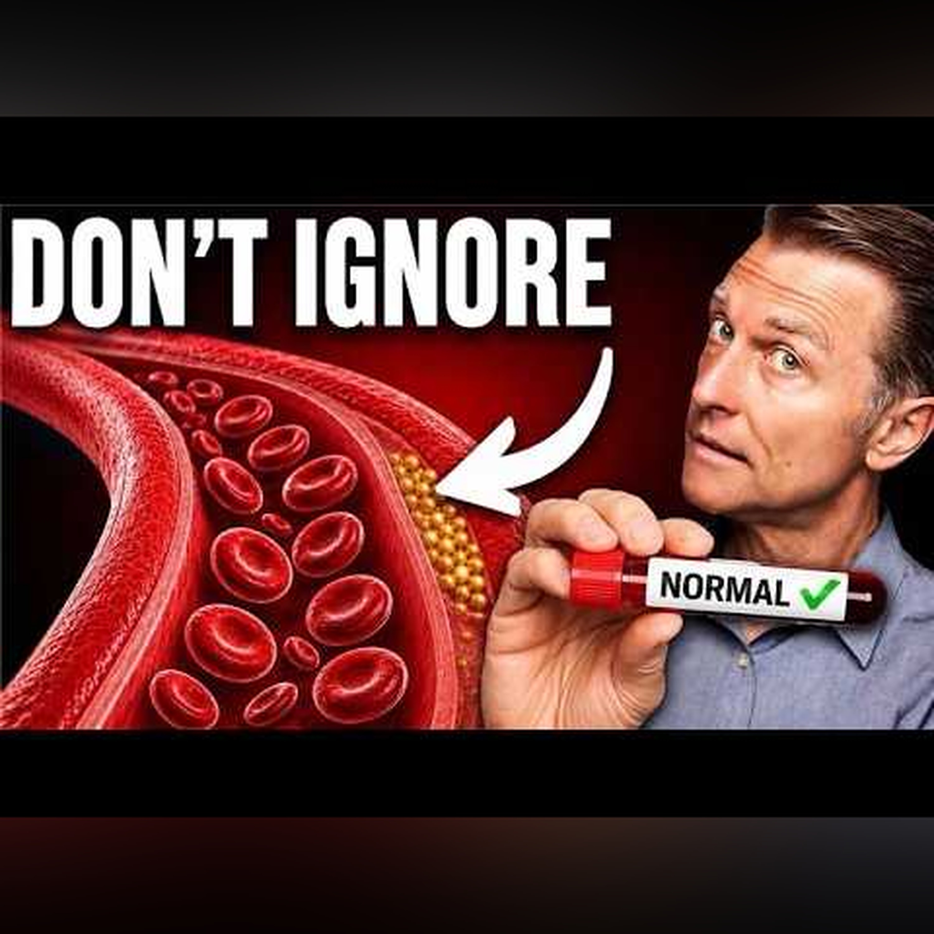 50% of Heart Attack Victims Had “Normal” Lab Results episode artwork