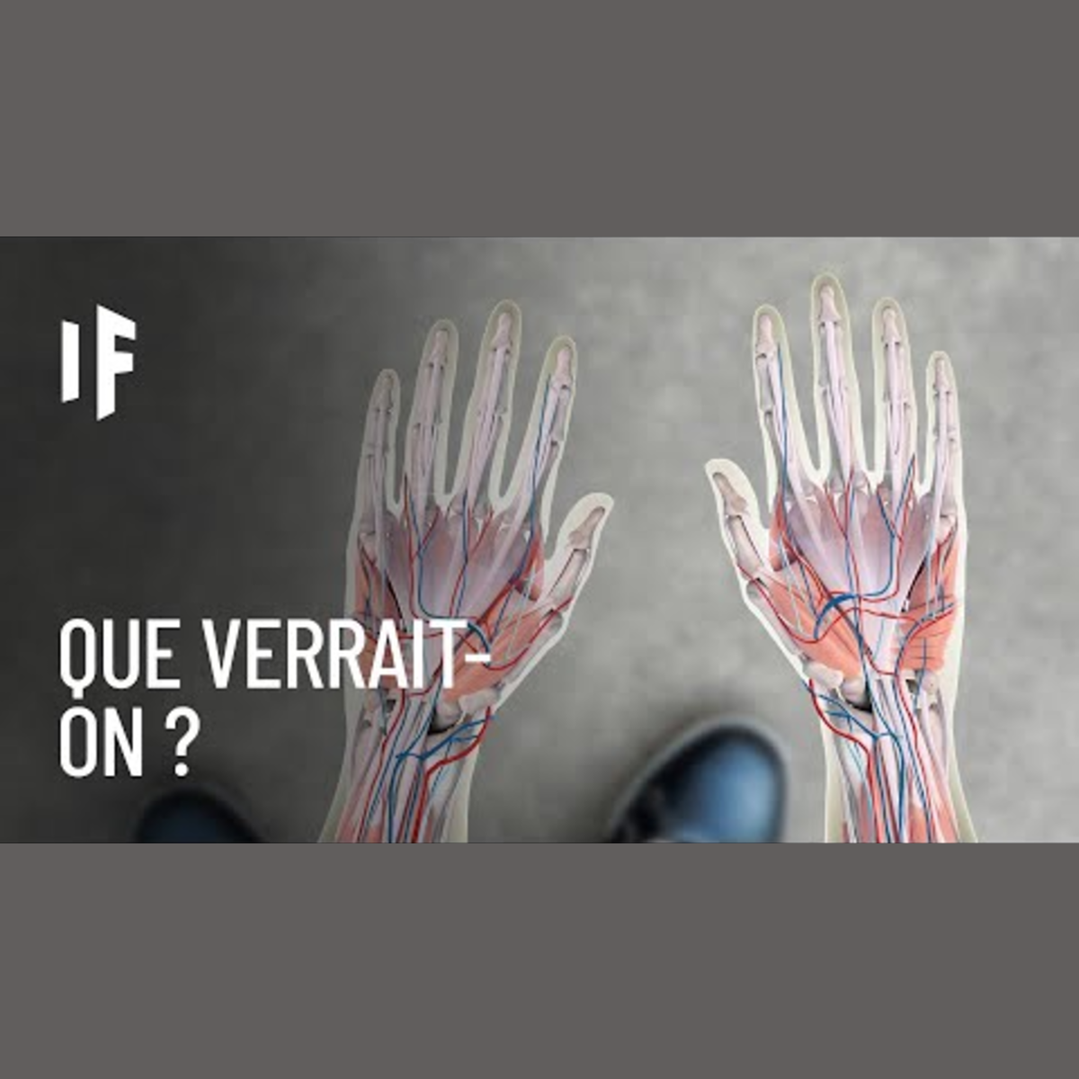 What If Français - Et Si