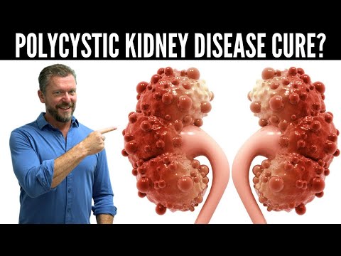 Polycystic Kidney Disease Breakthrough (New Research in PKD) - 2026