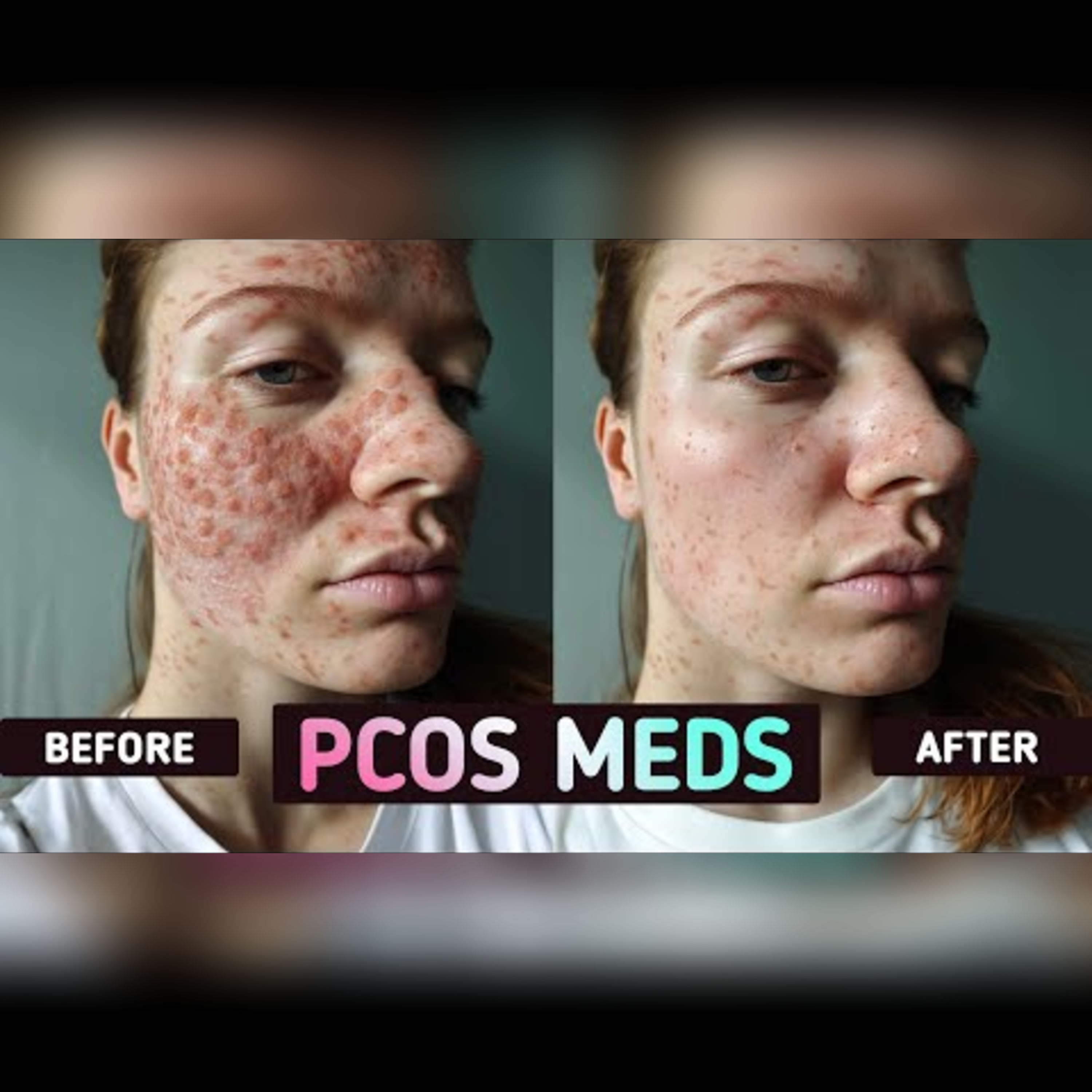 Embracing PCOS: Challenging Beauty Norms episode artwork