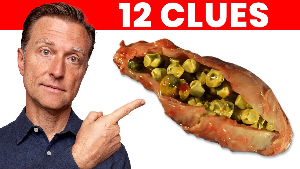 The 12 Signs that Your Gallbladder is in DANGER episode artwork