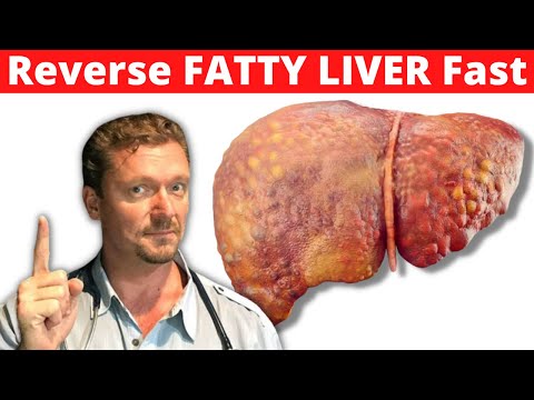 How Fast can KETO Reverse Fatty Liver? (Reverse NAFLD Fast)