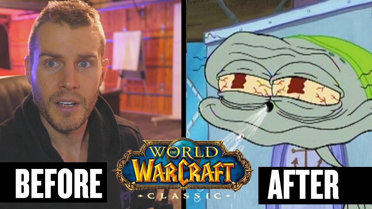 SEVERE! WoW Addiction Made My Brain "Grey" - Alex Becker Channel