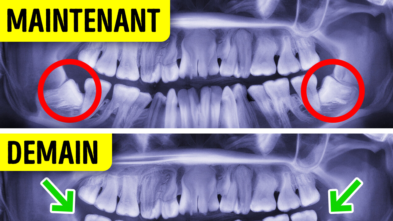 Le saviez-vous sur le corps humain le plus surprenant que vous entendrez jamais