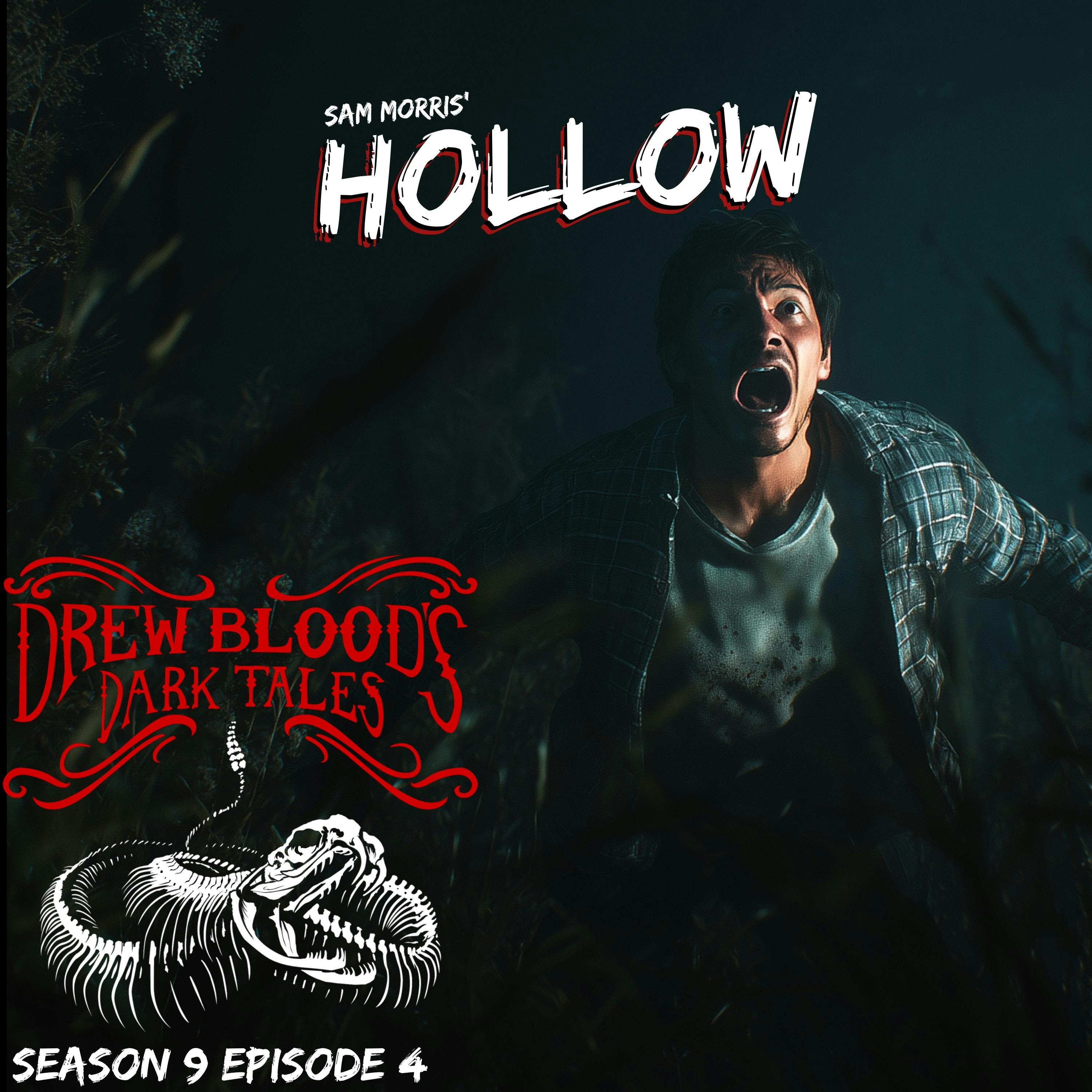 S9E04 - "Hollow" - Drew Blood S9E04 - "Hollow" - Drew Blood