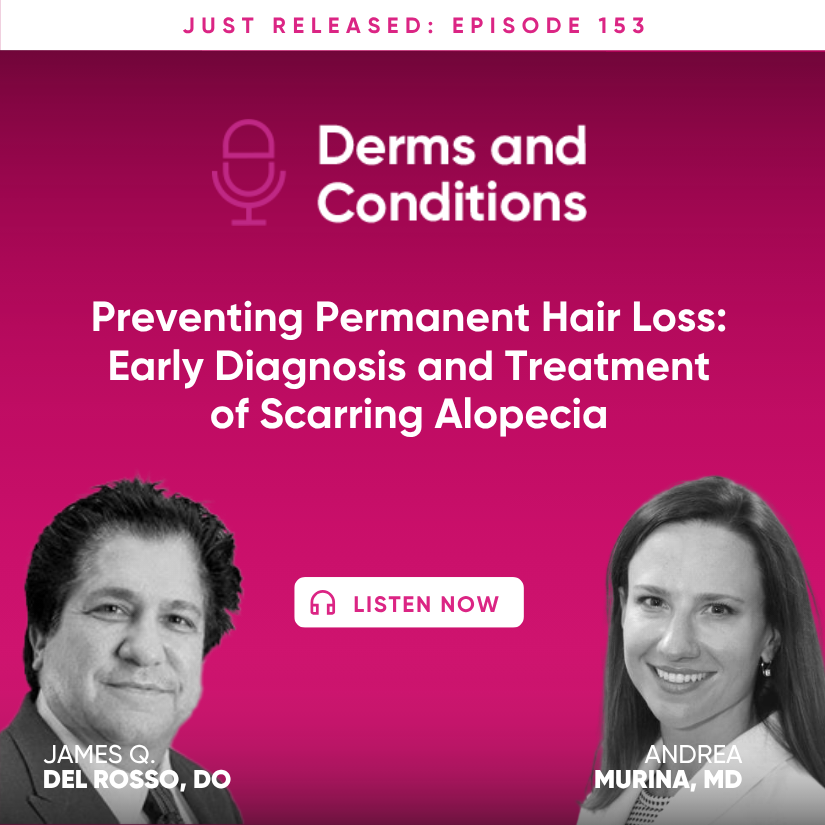 Preventing Permanent Hair Loss: Early Diagnosis and Treatment of Scarring Alopecia episode artwork