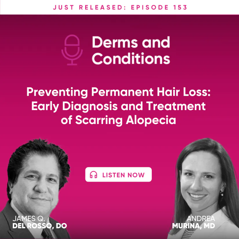 Preventing Permanent Hair Loss: Early Diagnosis and Treatment of Scarring Alopecia episode artwork