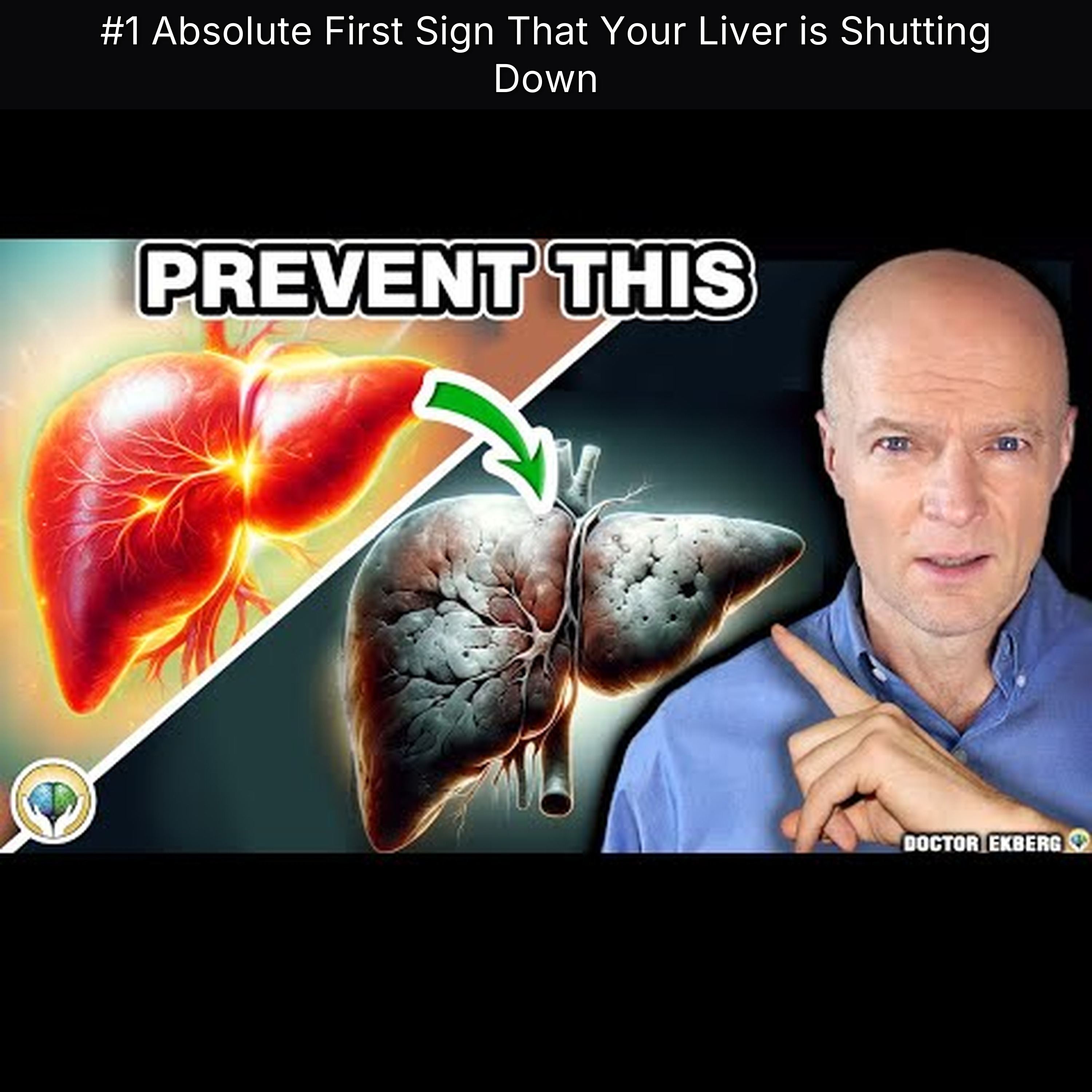 #1 Absolute First Sign That Your Liver is Shutting Down episode artwork