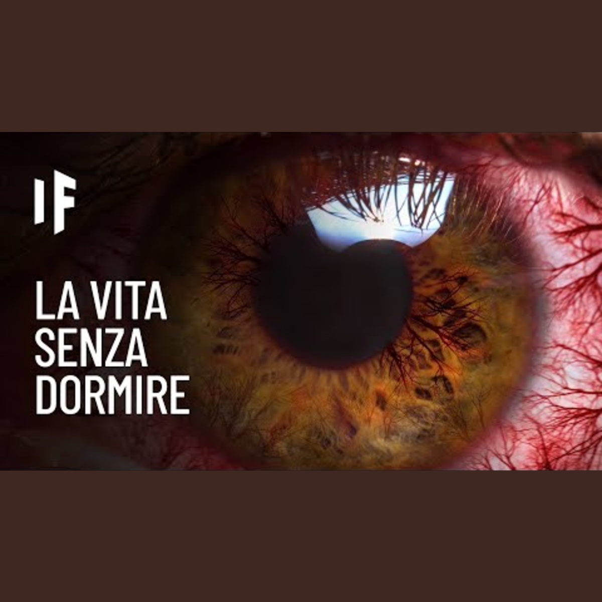 E se smettessi di dormire? episode artwork