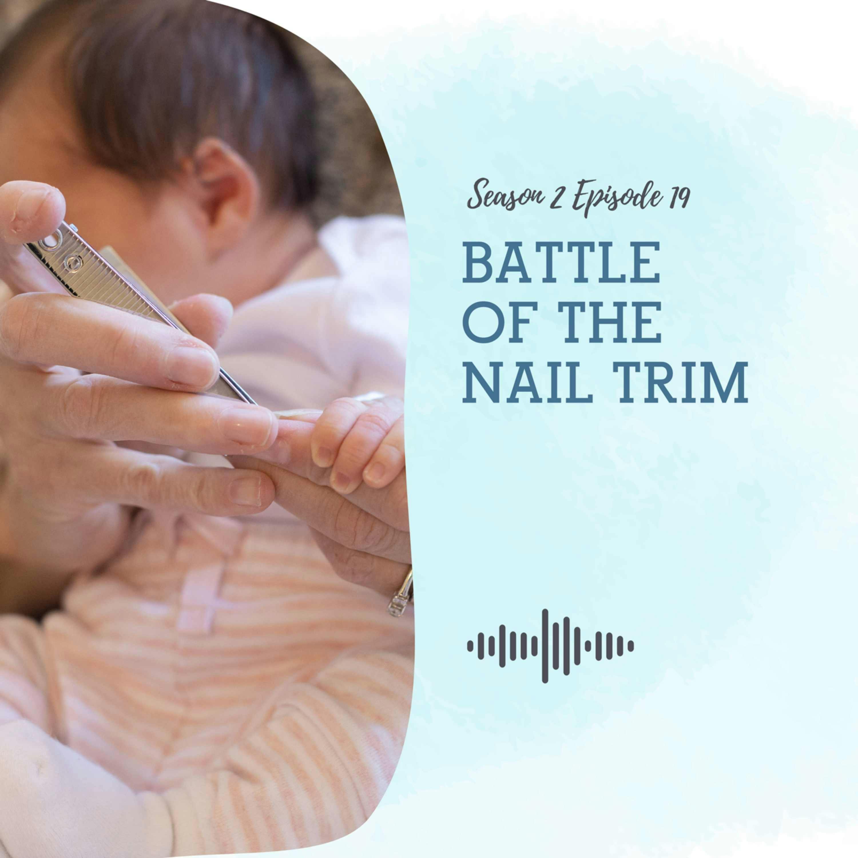 S2 EP19:  BATTLE OF THE NAIL TRIM