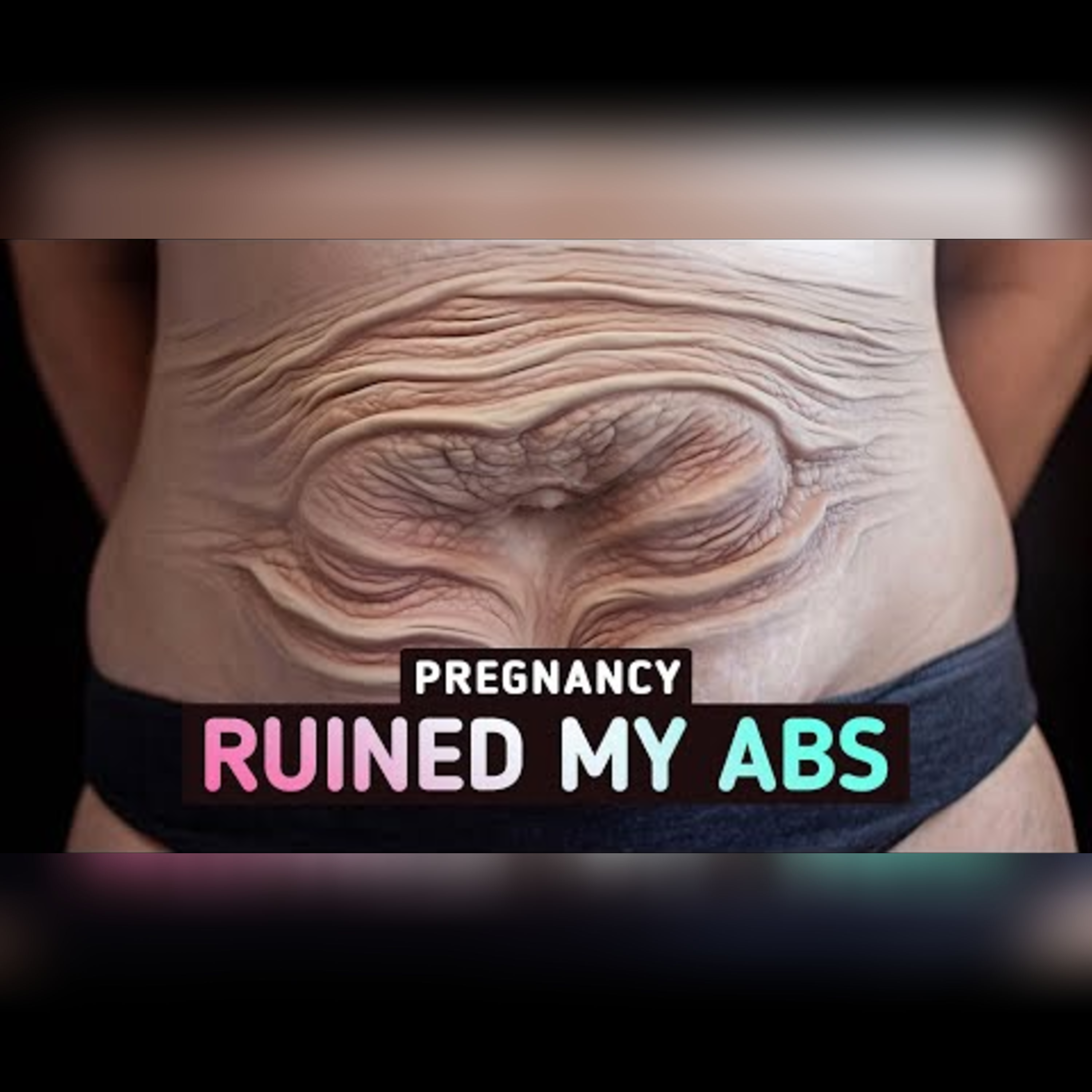Understanding Diastasis Recti: Postpartum Abs Explained episode artwork