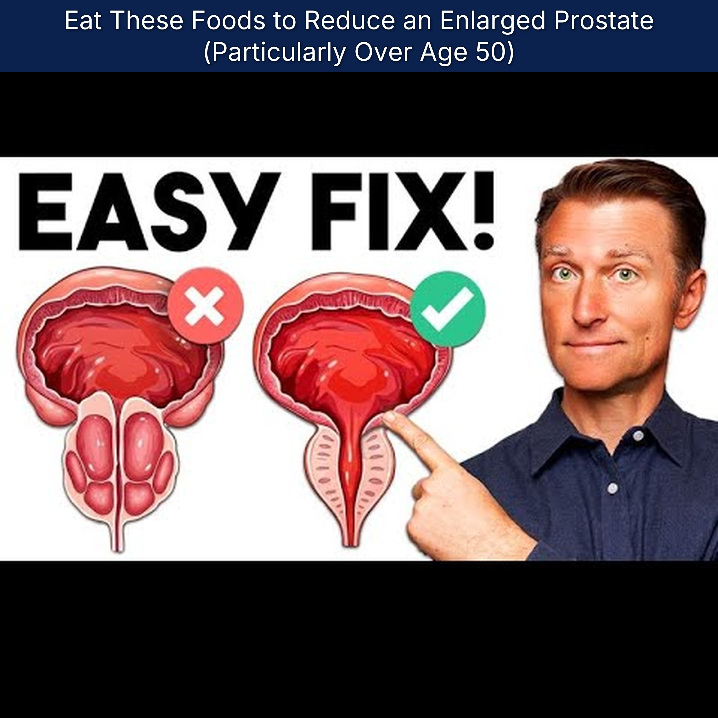 Eat These Foods to Reduce an Enlarged Prostate (Particularly Over Age 50)