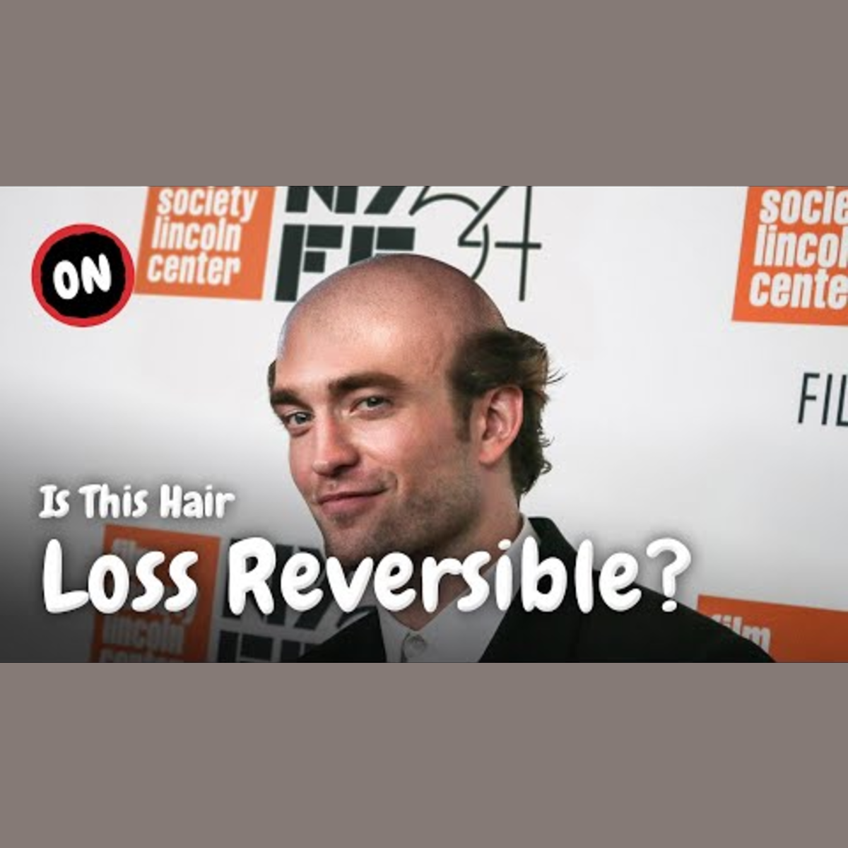 Top 5 Indicators of Balding episode artwork