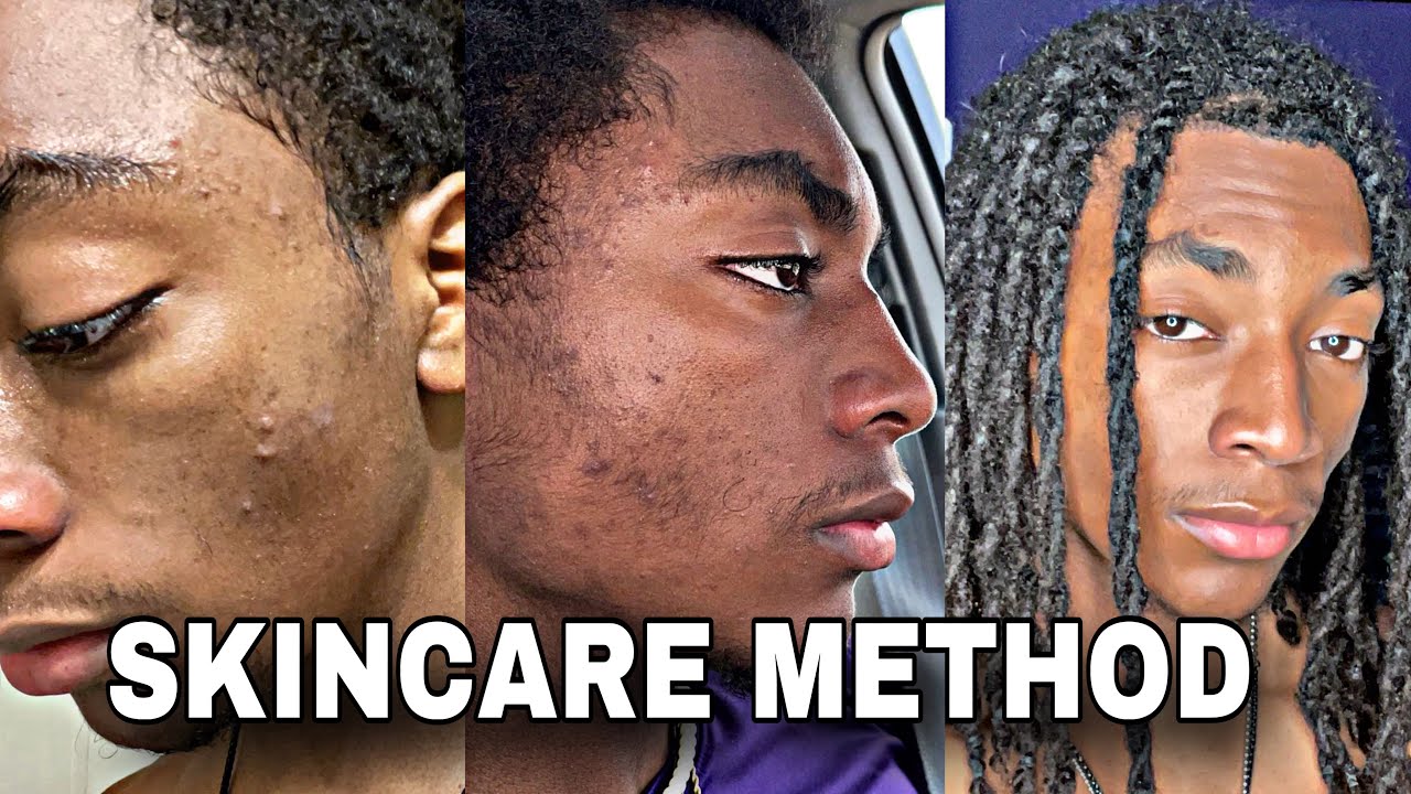 How I Cleared My SKIN (EASY) | Shimon Davis